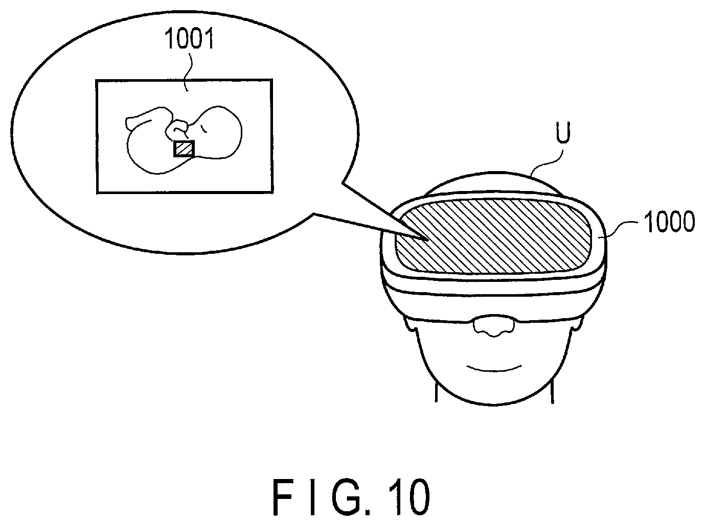 Patent US12310786 Figure 8 – Ultrasonic diagnostic apparatus and ultrasonic diagnostic method