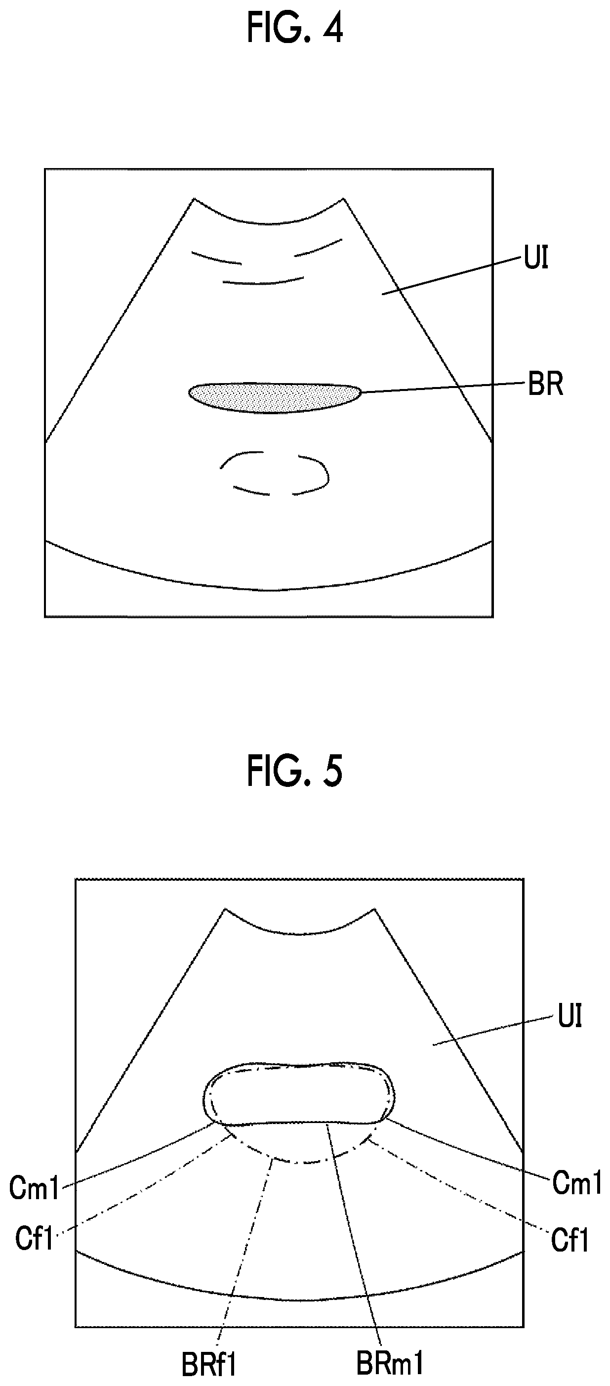 Patent US12310787 Figure 3 – Ultrasound diagnostic apparatus and control method for ultrasound diagnostic apparatus capable of performing urinary organ examination according to gender of subject