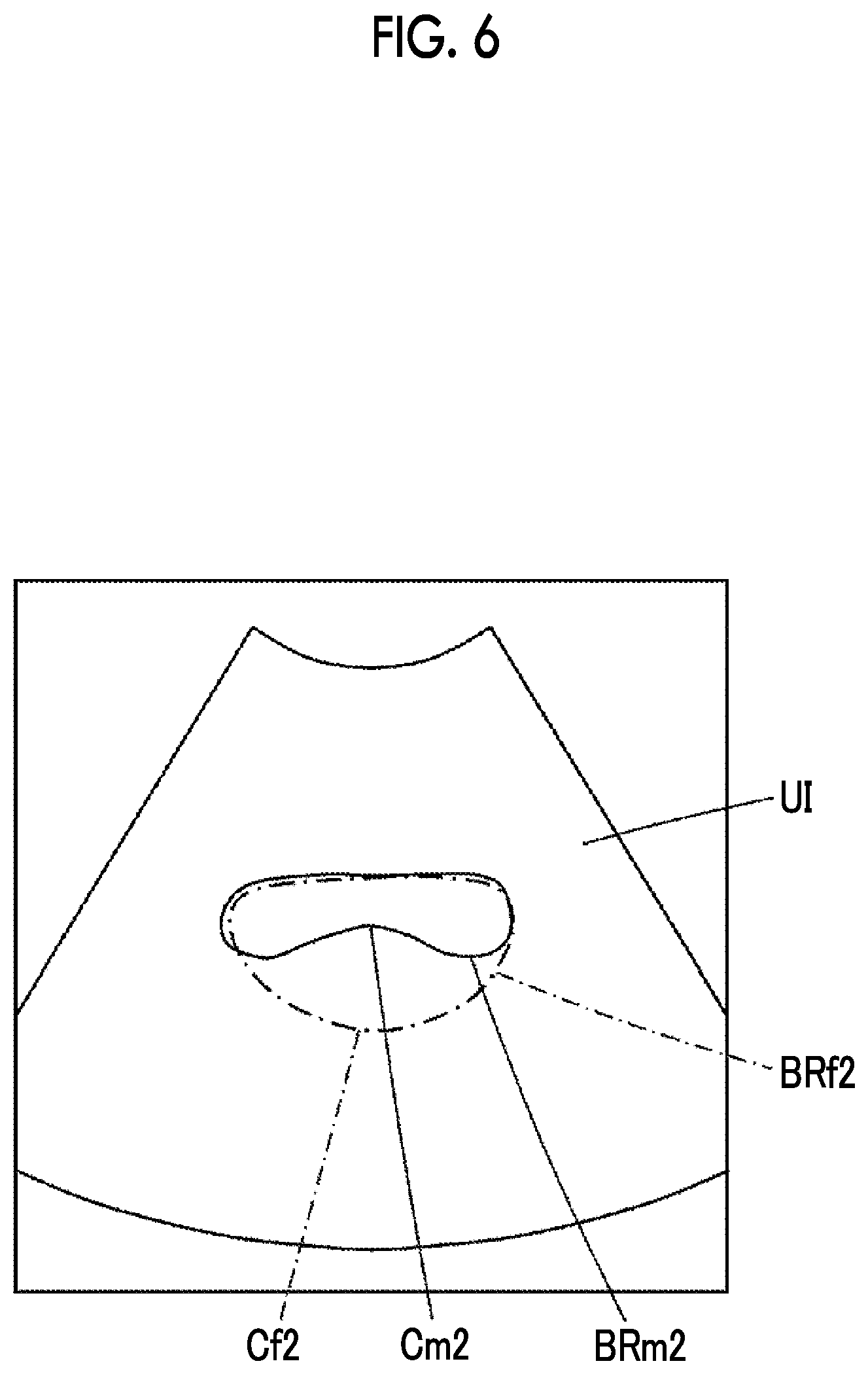 Patent US12310787 Figure 4 – Ultrasound diagnostic apparatus and control method for ultrasound diagnostic apparatus capable of performing urinary organ examination according to gender of subject