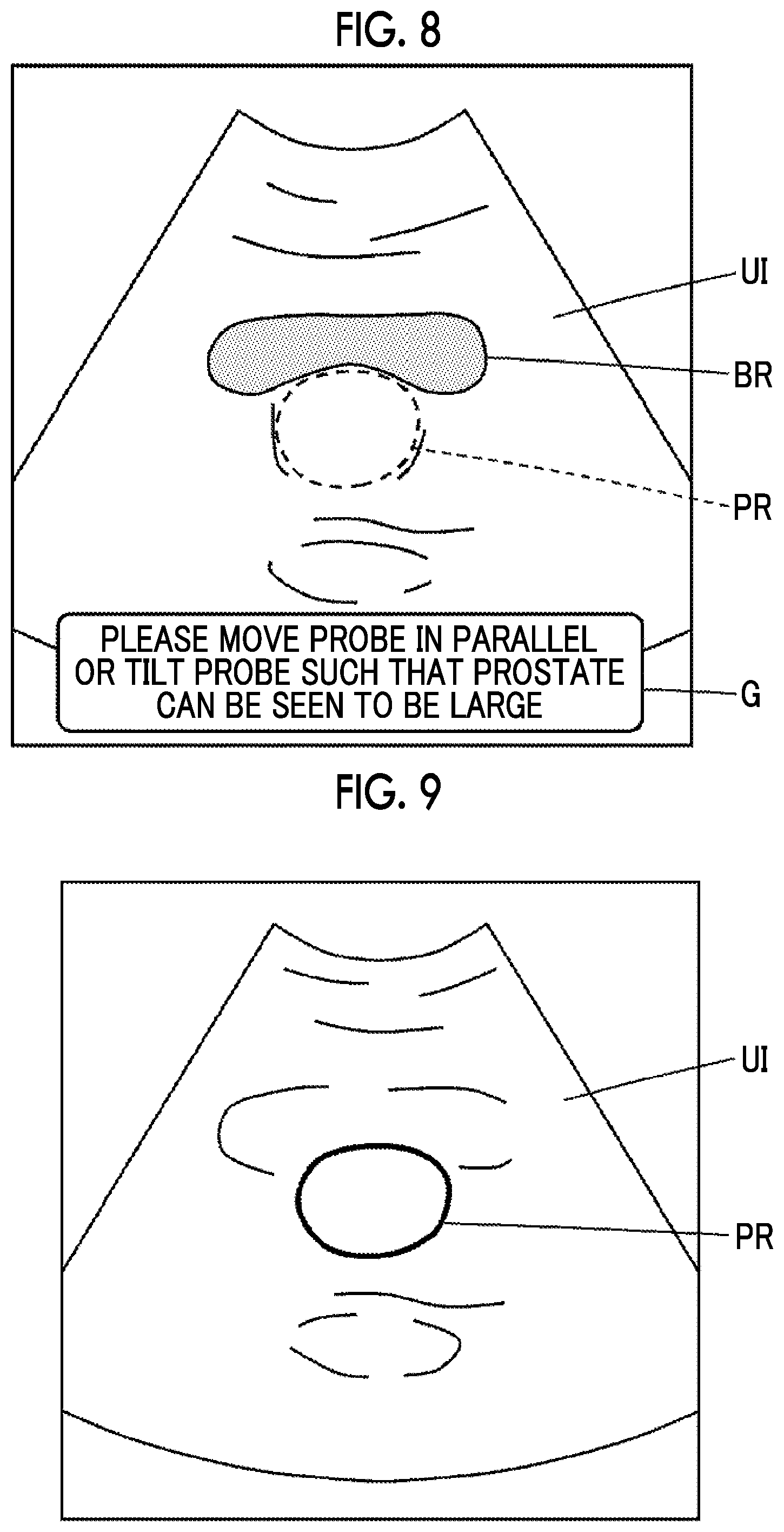 Patent US12310787 Figure 6 – Ultrasound diagnostic apparatus and control method for ultrasound diagnostic apparatus capable of performing urinary organ examination according to gender of subject