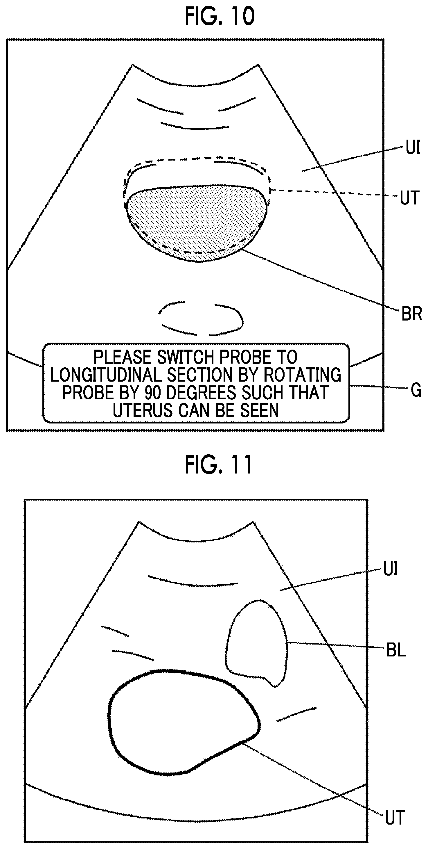 Patent US12310787 Figure 7 – Ultrasound diagnostic apparatus and control method for ultrasound diagnostic apparatus capable of performing urinary organ examination according to gender of subject