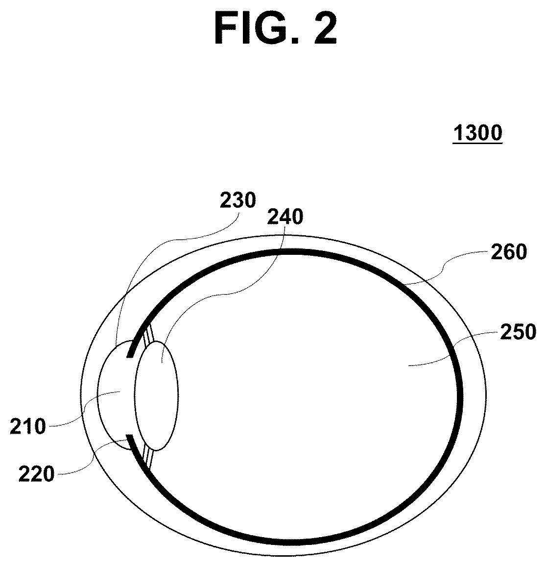 Patent US12310788 Figure 2 – System for measuring intraocular pressure