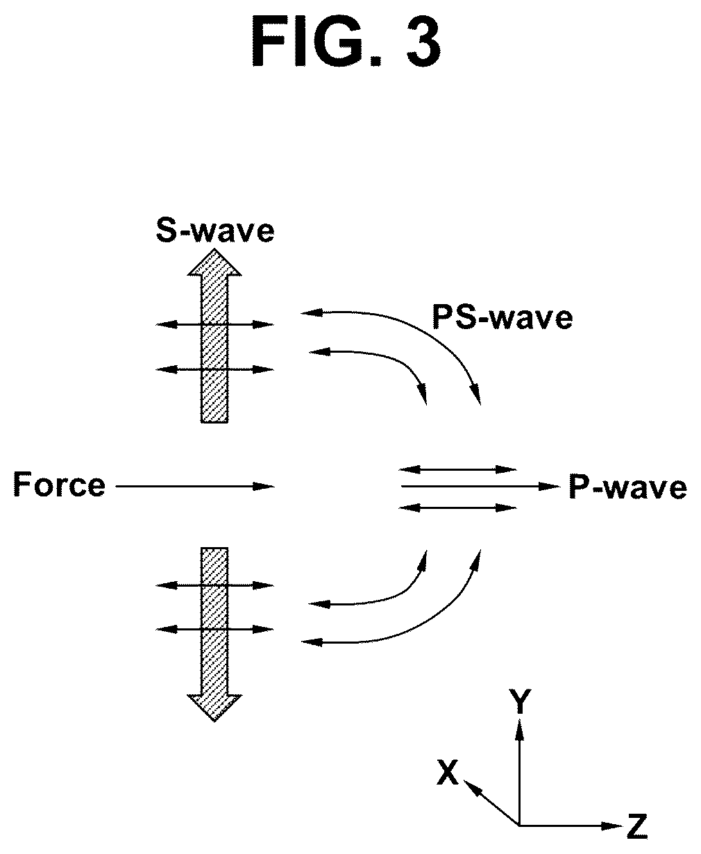 Patent US12310788 Figure 3 – System for measuring intraocular pressure