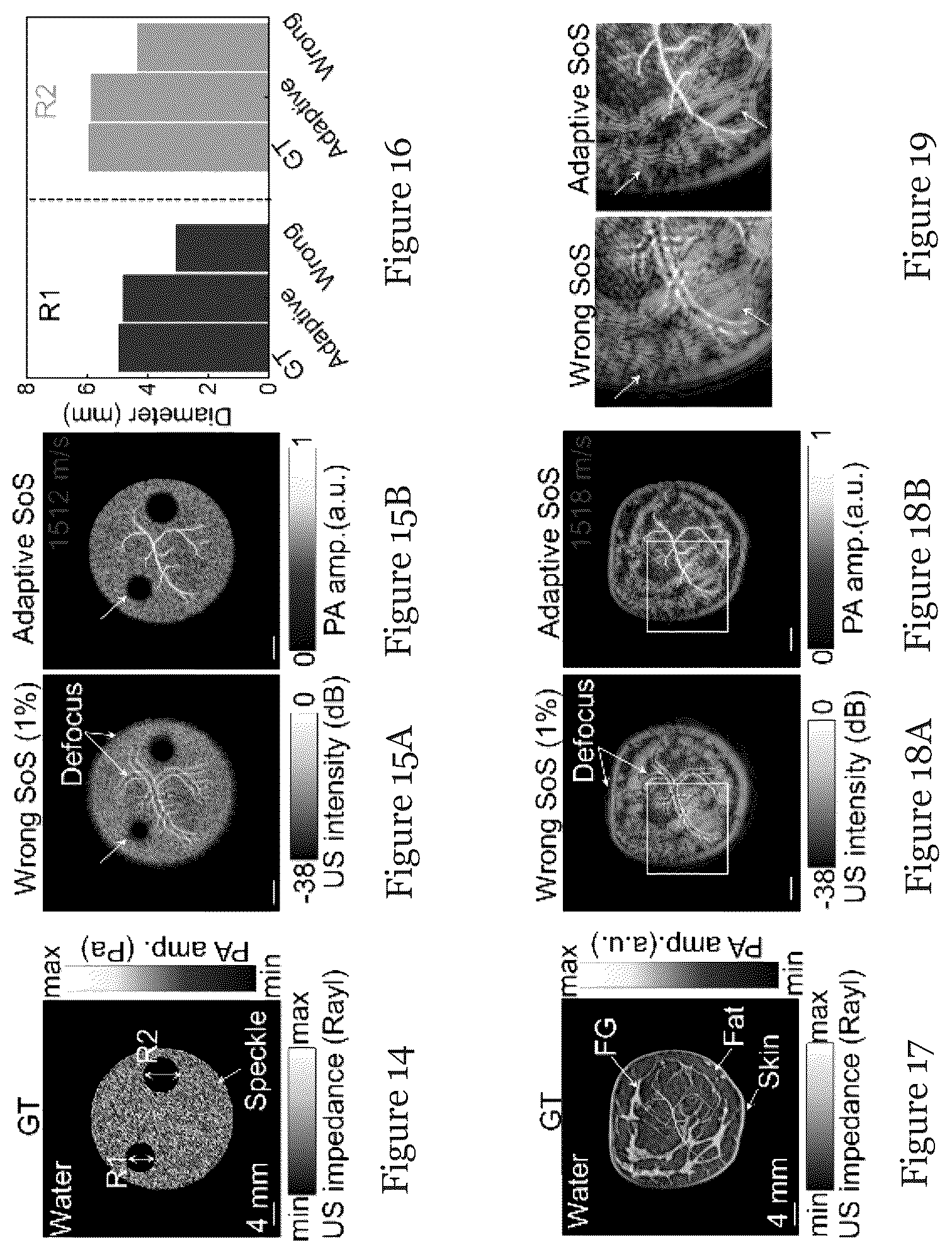 Patent US12310793 Figure 8 – System and method for photoacoustic imaging and ultrasound imaging