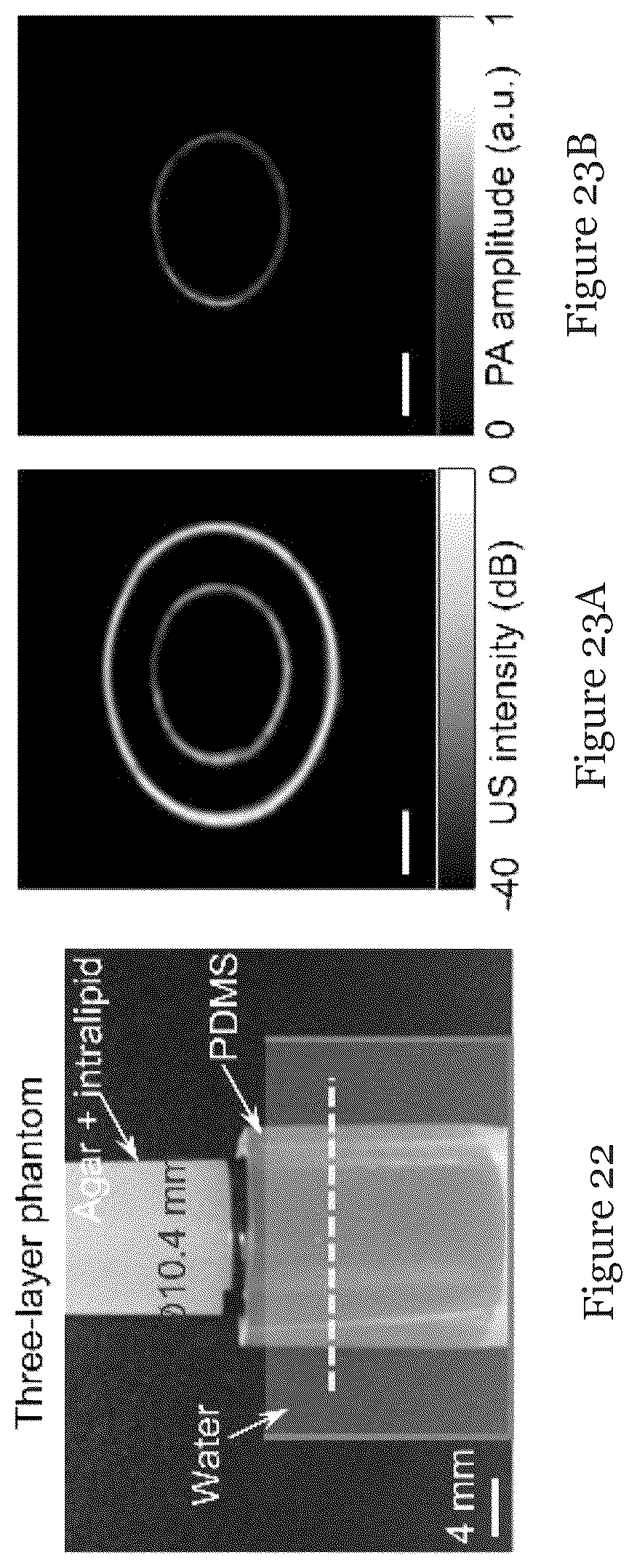 Patent US12310793 Figure 10 – System and method for photoacoustic imaging and ultrasound imaging