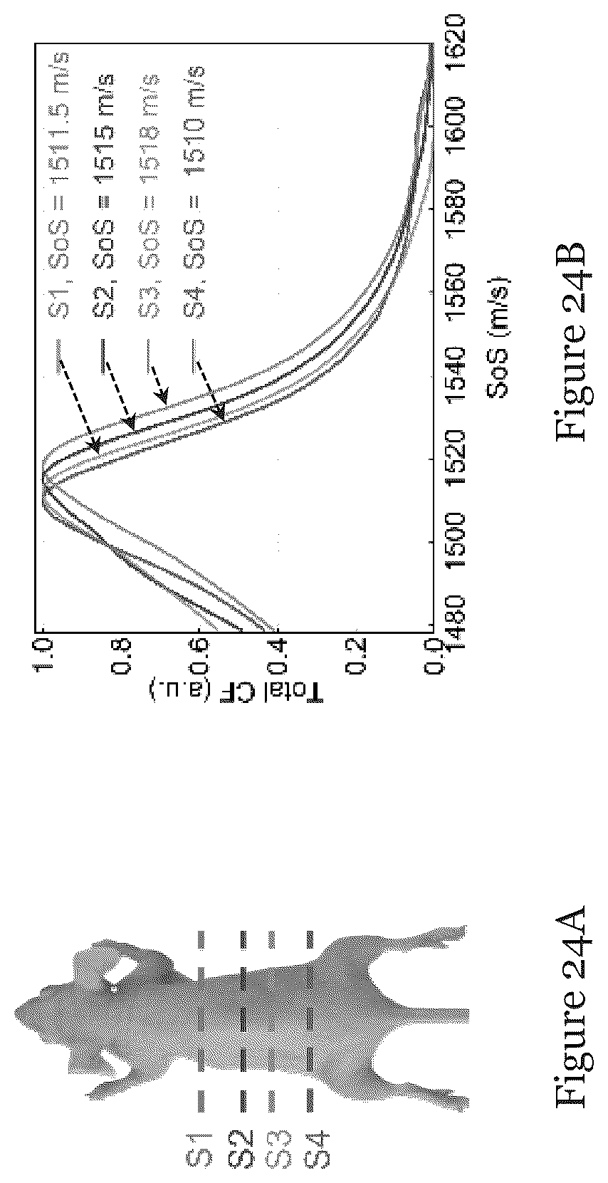Patent US12310793 Figure 11 – System and method for photoacoustic imaging and ultrasound imaging