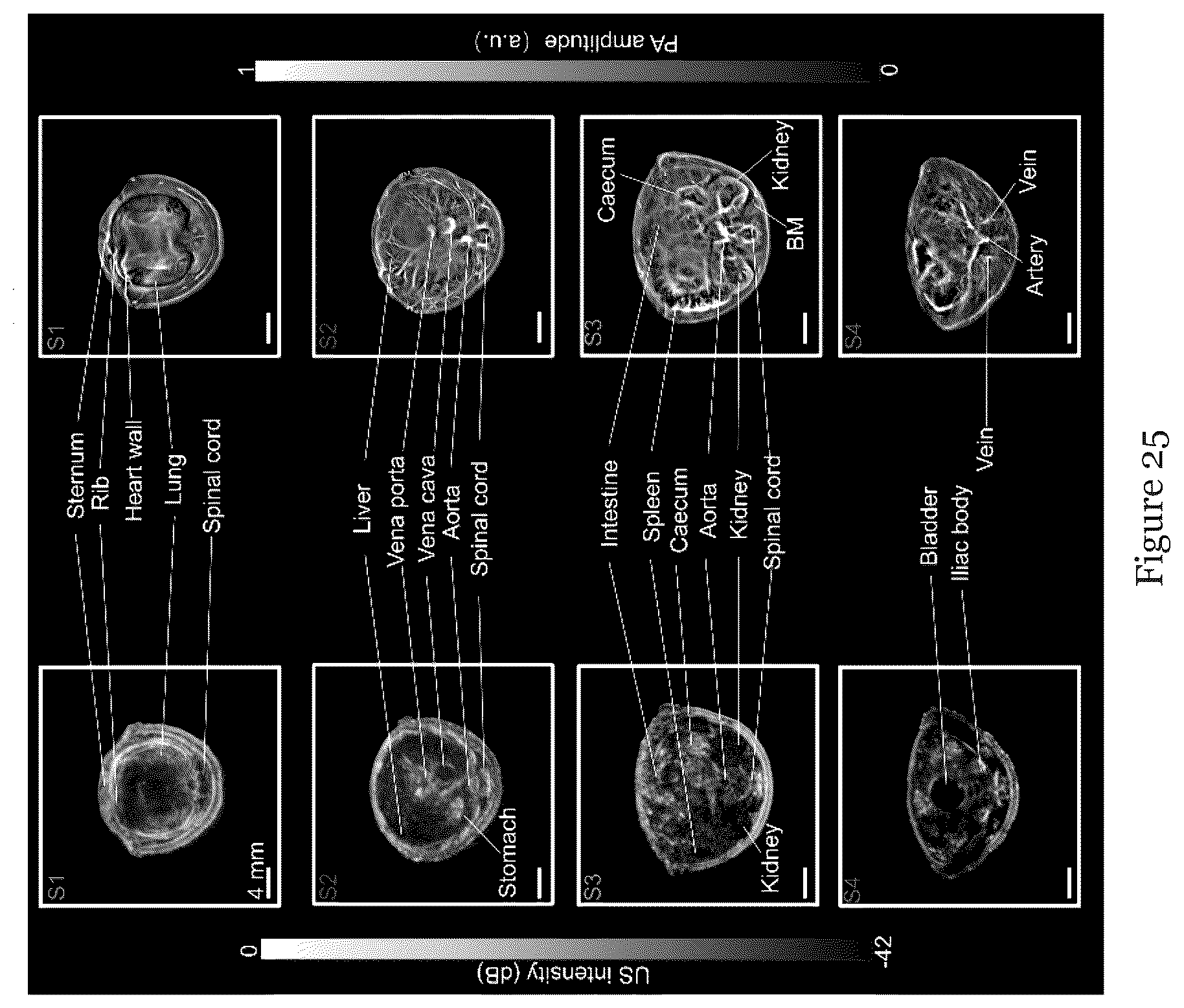 Patent US12310793 Figure 12 – System and method for photoacoustic imaging and ultrasound imaging