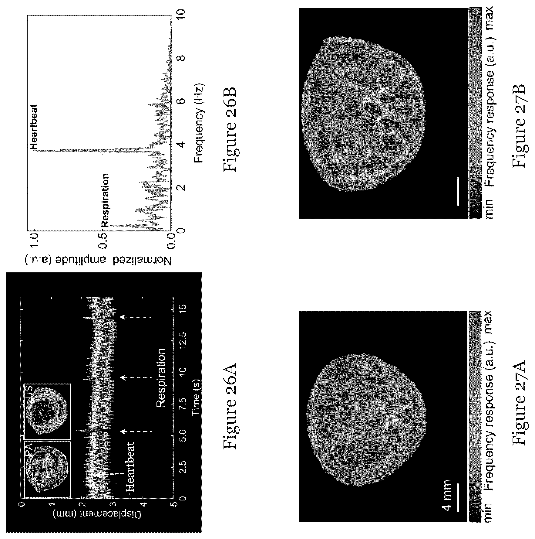 Patent US12310793 Figure 13 – System and method for photoacoustic imaging and ultrasound imaging