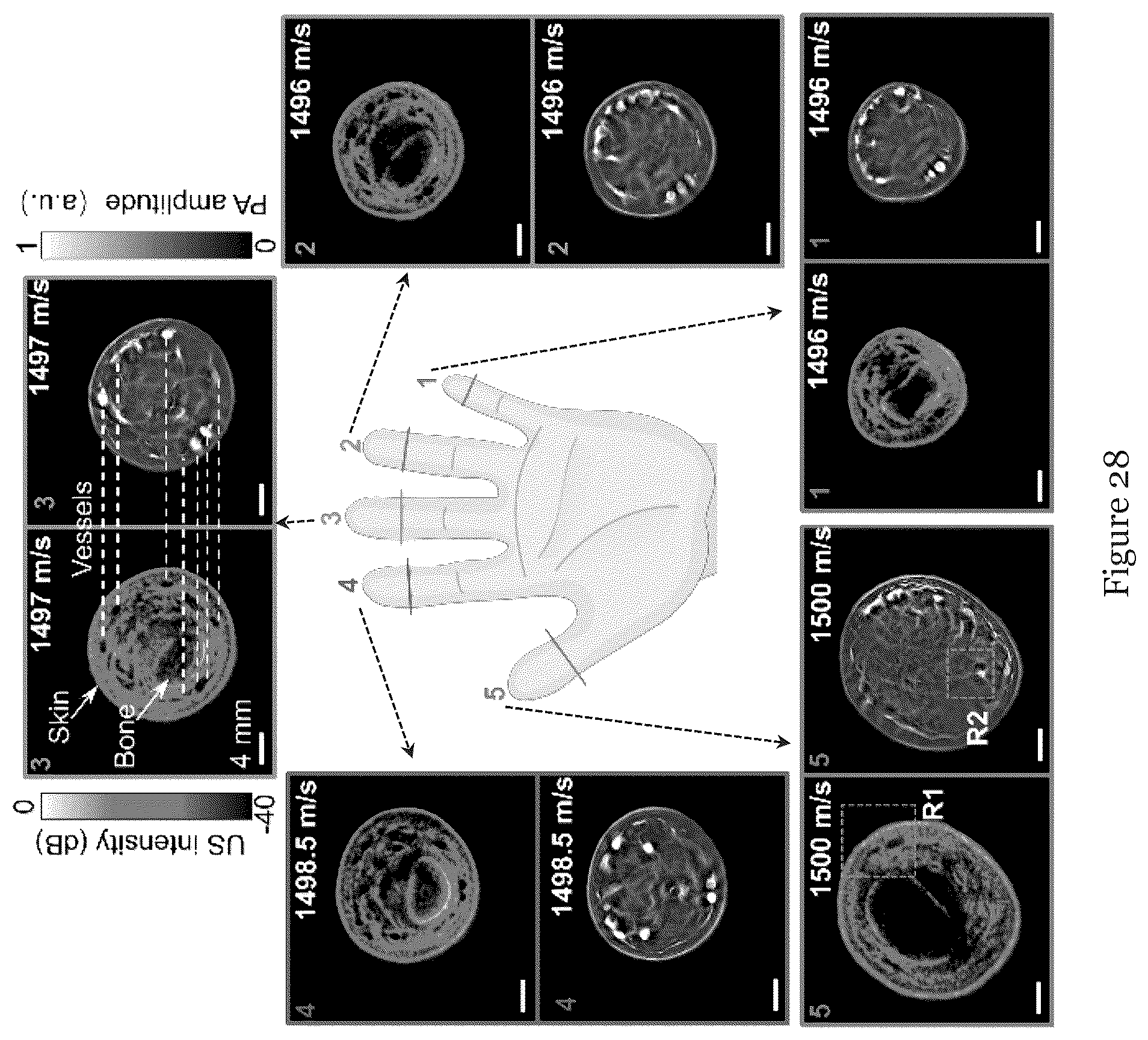 Patent US12310793 Figure 14 – System and method for photoacoustic imaging and ultrasound imaging
