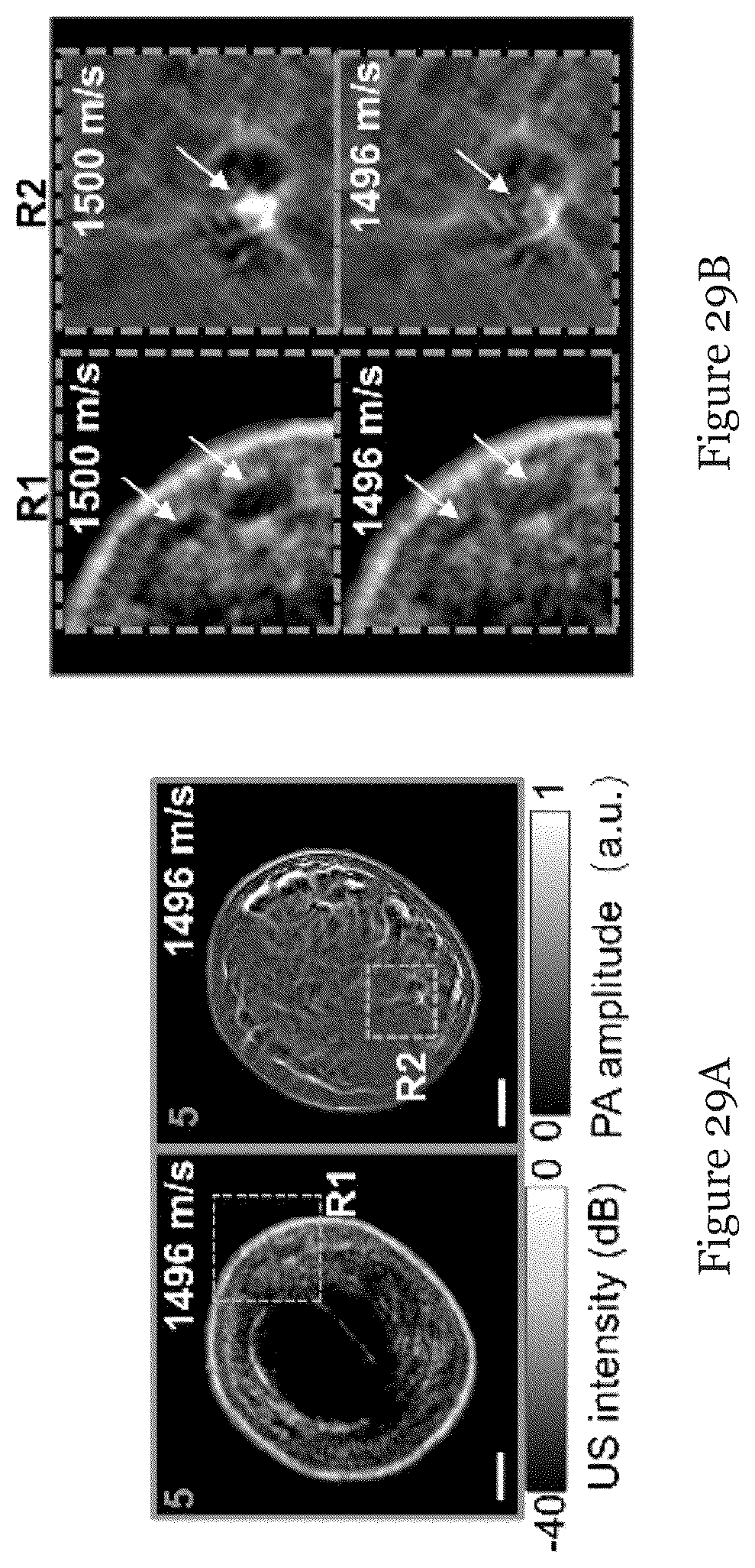 Patent US12310793 Figure 15 – System and method for photoacoustic imaging and ultrasound imaging