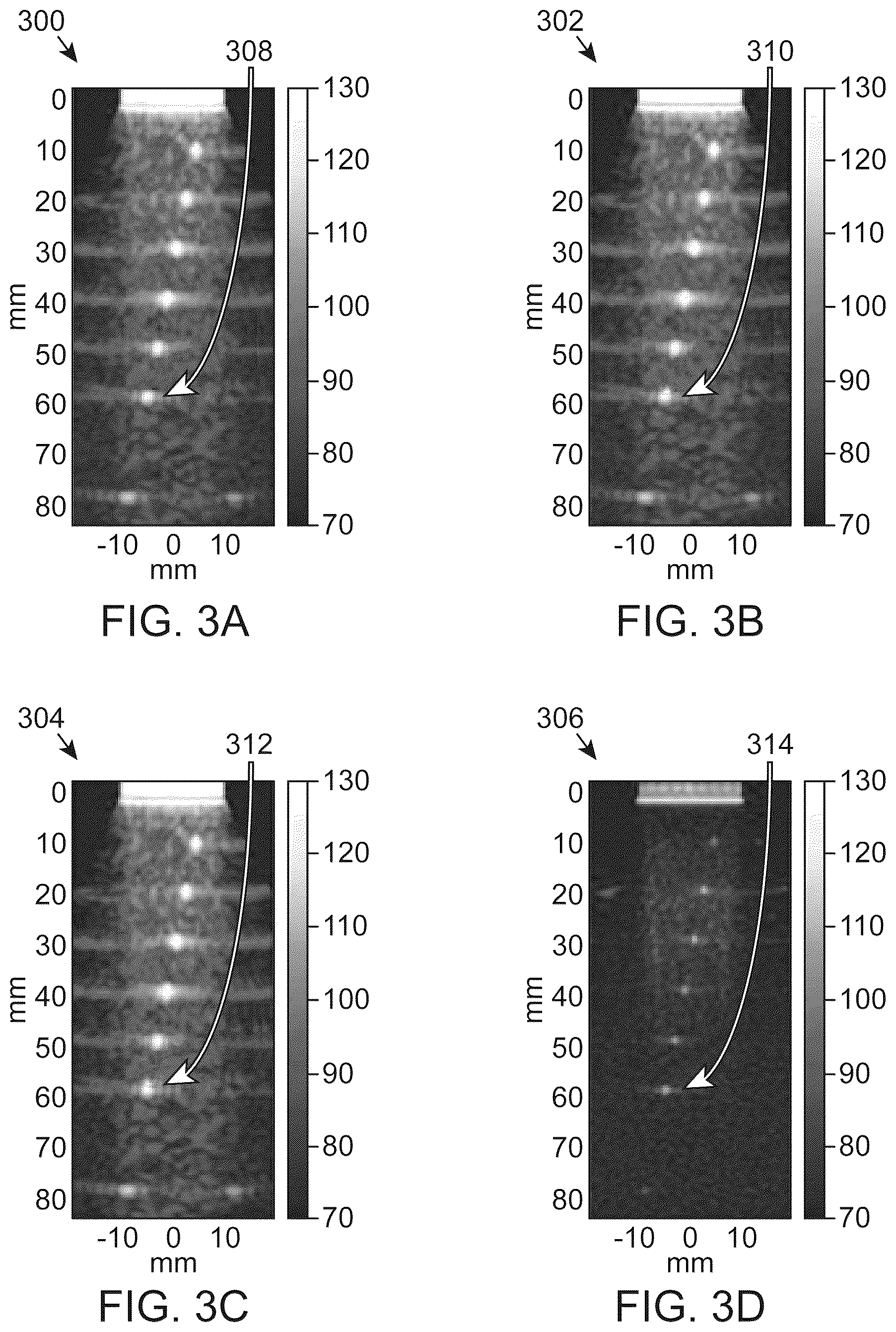 Patent US12310794 Figure 3 – Ultrasonic characterization of non-linear properties of tissue
