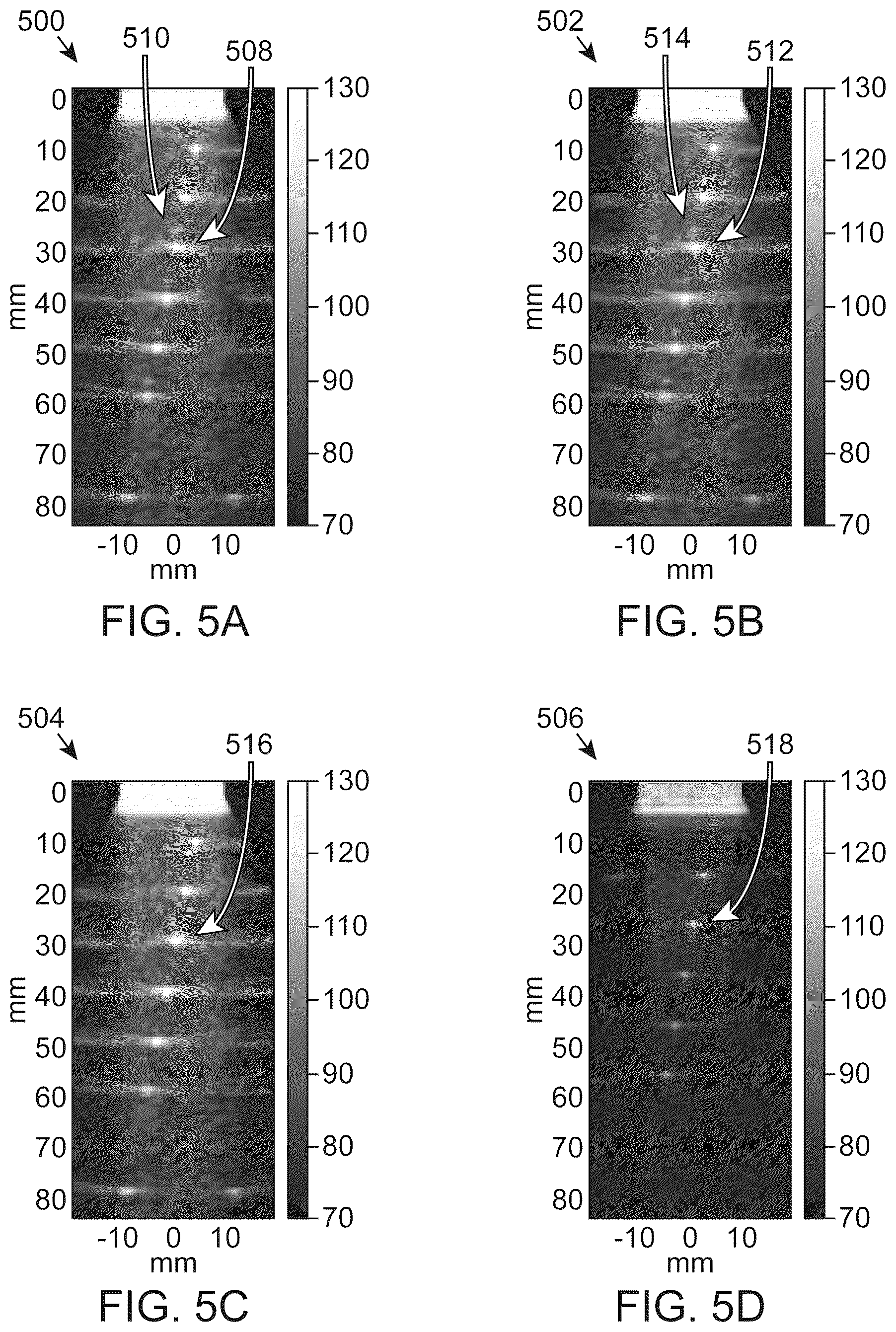 Patent US12310794 Figure 5 – Ultrasonic characterization of non-linear properties of tissue