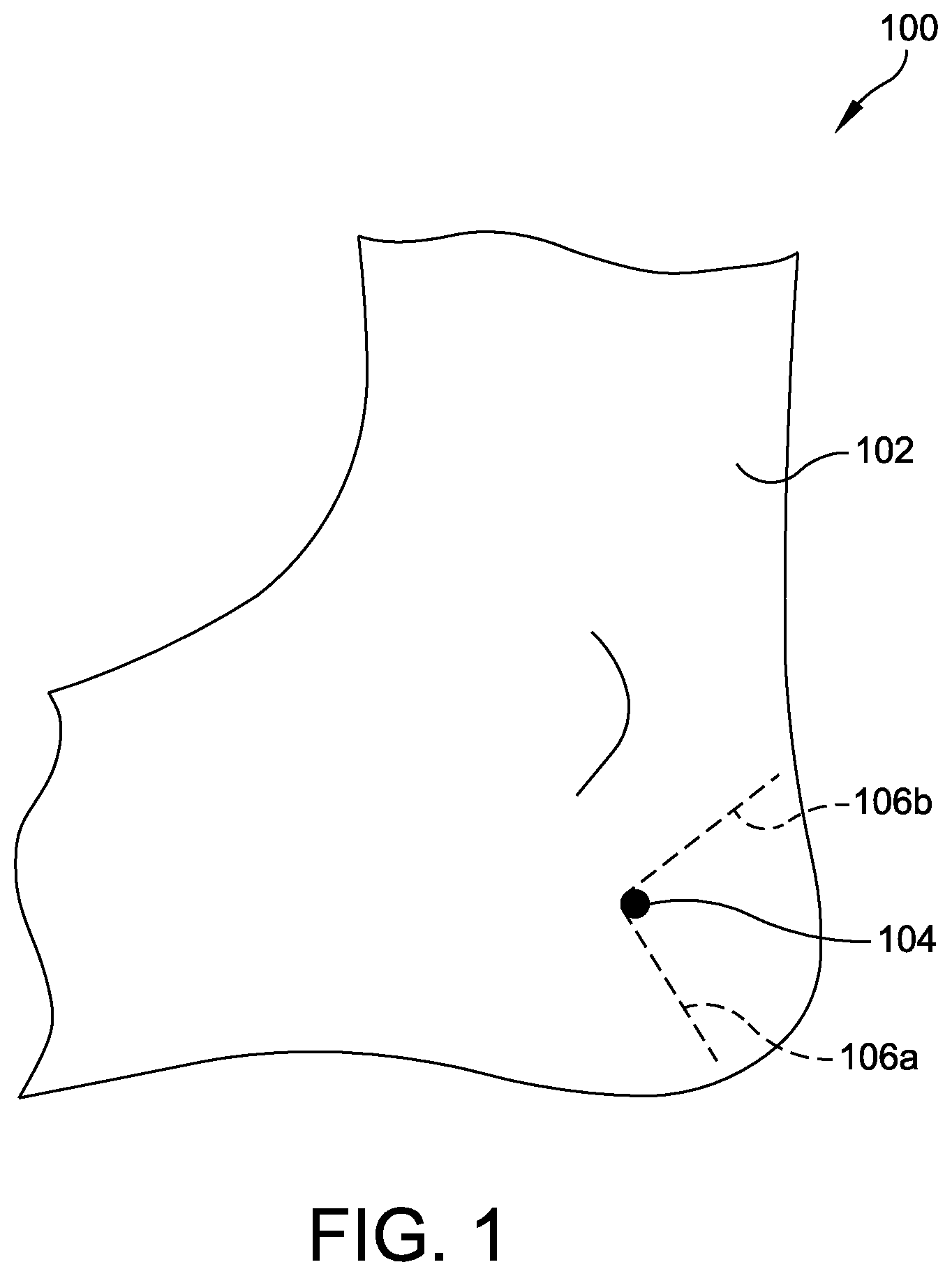 Patent US12310799 Figure 1 – Minimally invasive surgery laser guide