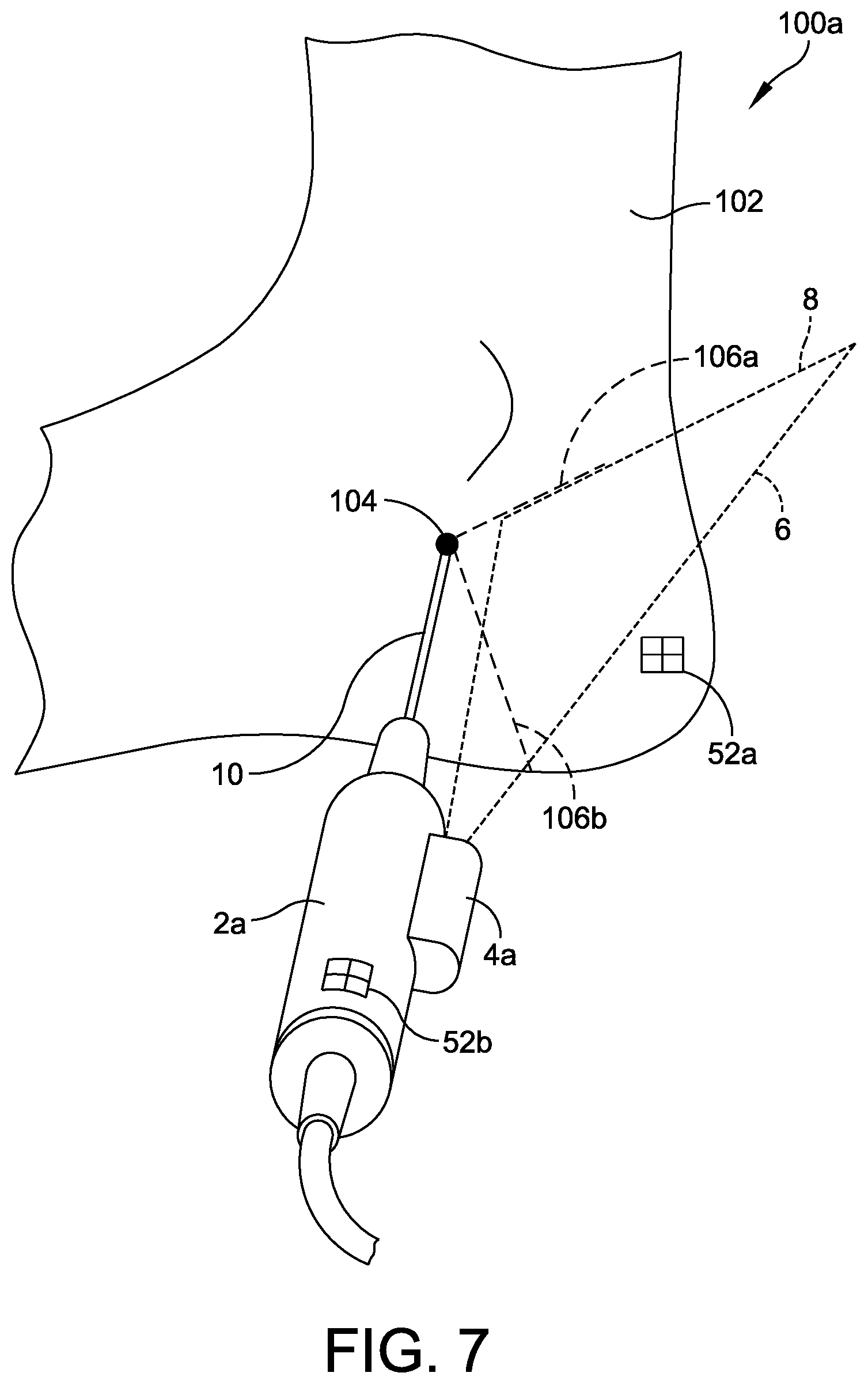 Patent US12310799 Figure 7 – Minimally invasive surgery laser guide