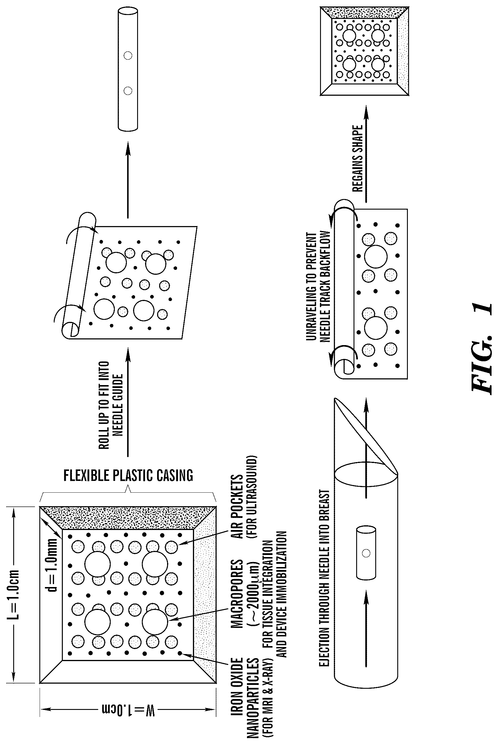 Patent US12310800 Figure 1 – Injection applicator for tissue markers