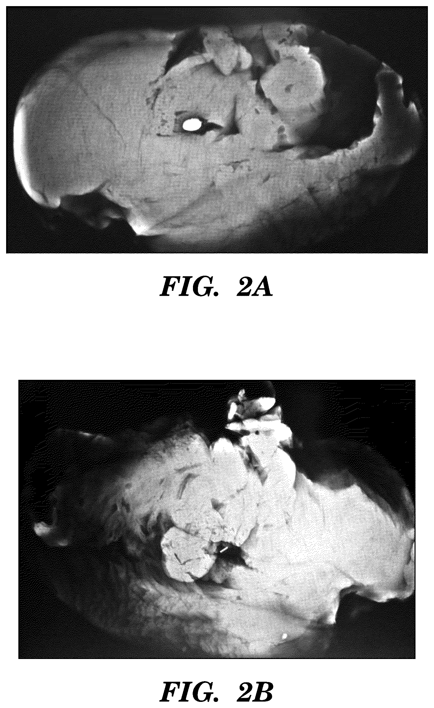 Patent US12310800 Figure 2 – Injection applicator for tissue markers