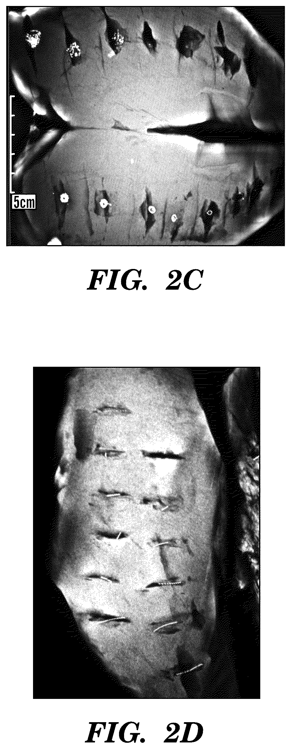 Patent US12310800 Figure 3 – Injection applicator for tissue markers