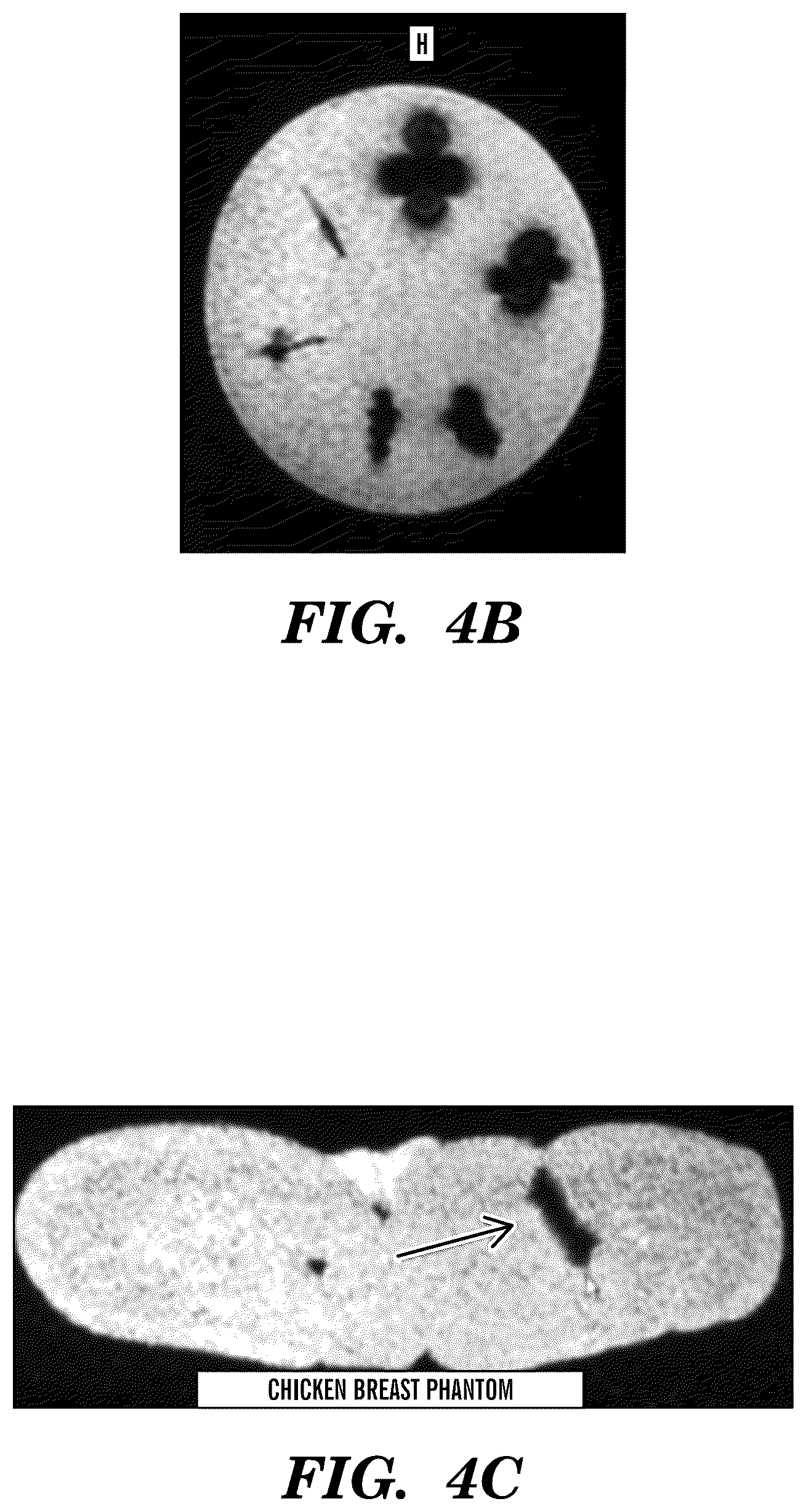 Patent US12310800 Figure 5 – Injection applicator for tissue markers