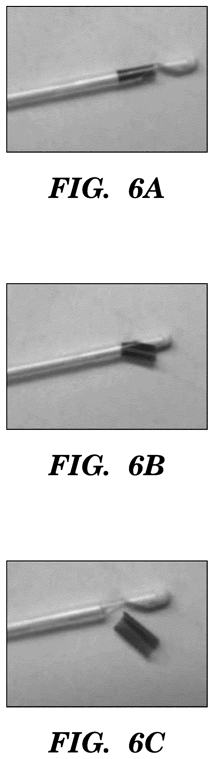 Patent US12310800 Figure 7 – Injection applicator for tissue markers