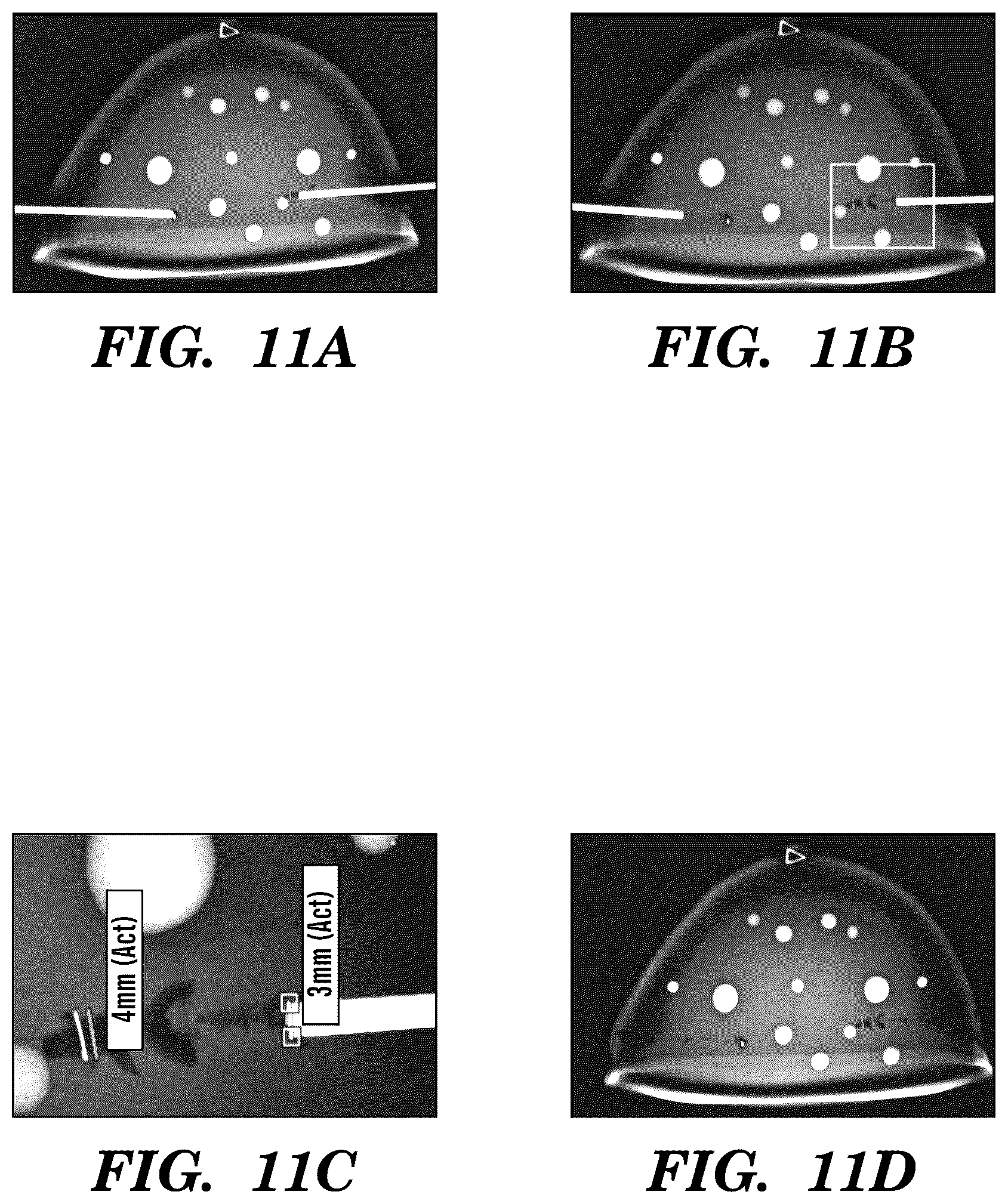 Patent US12310800 Figure 10 – Injection applicator for tissue markers