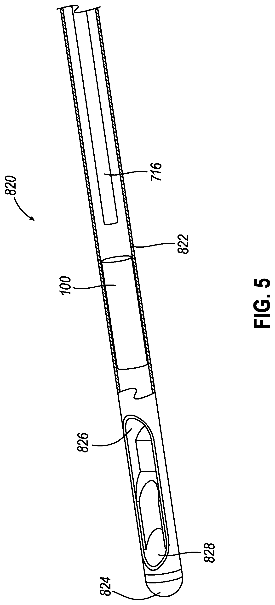 Patent US12310801 Figure 5 – Apparatus for delivering biopsy cavity marker
