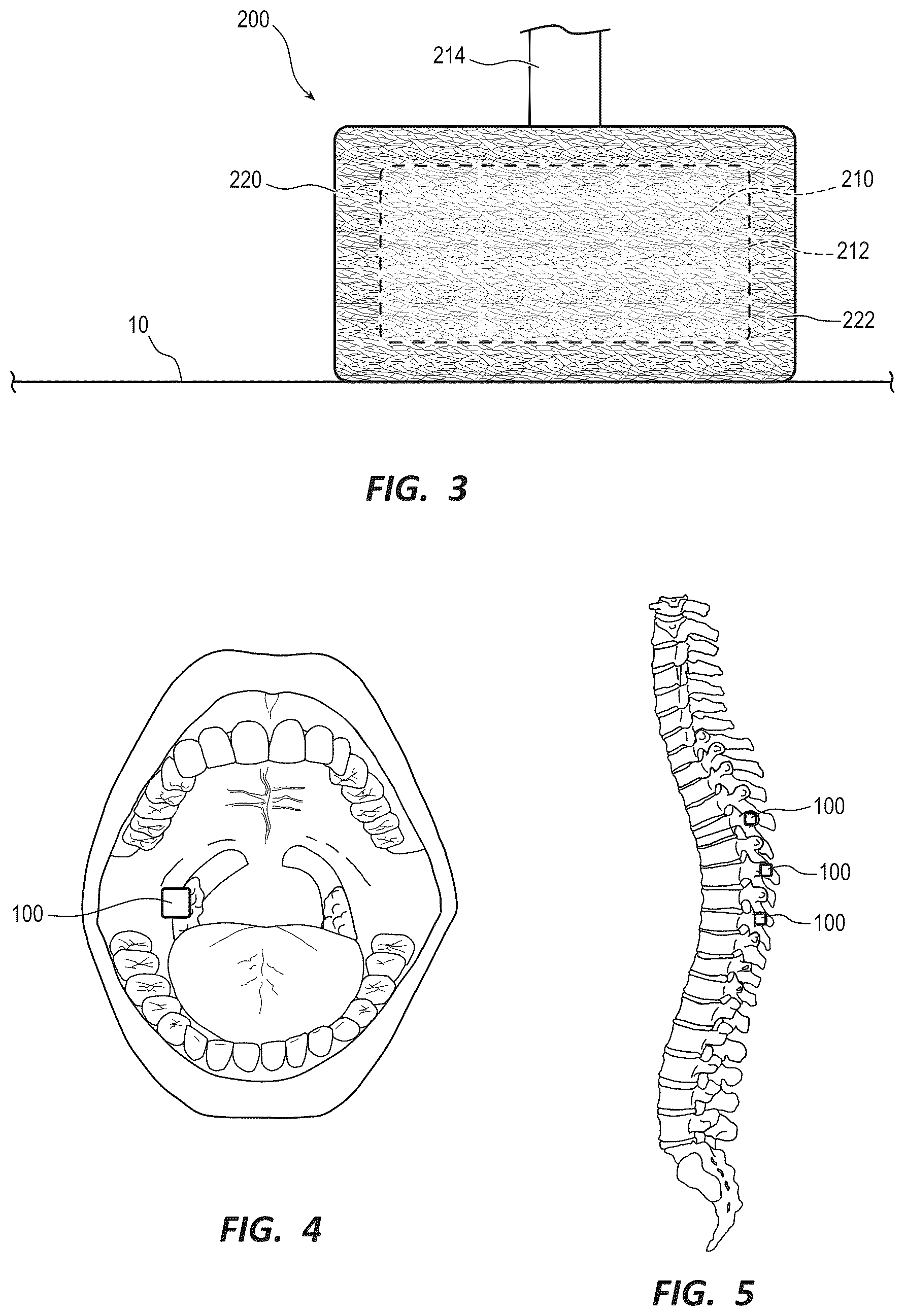 Patent US12310802 Figure 2 – Nanofiber adhesives for navigation tracker fixation