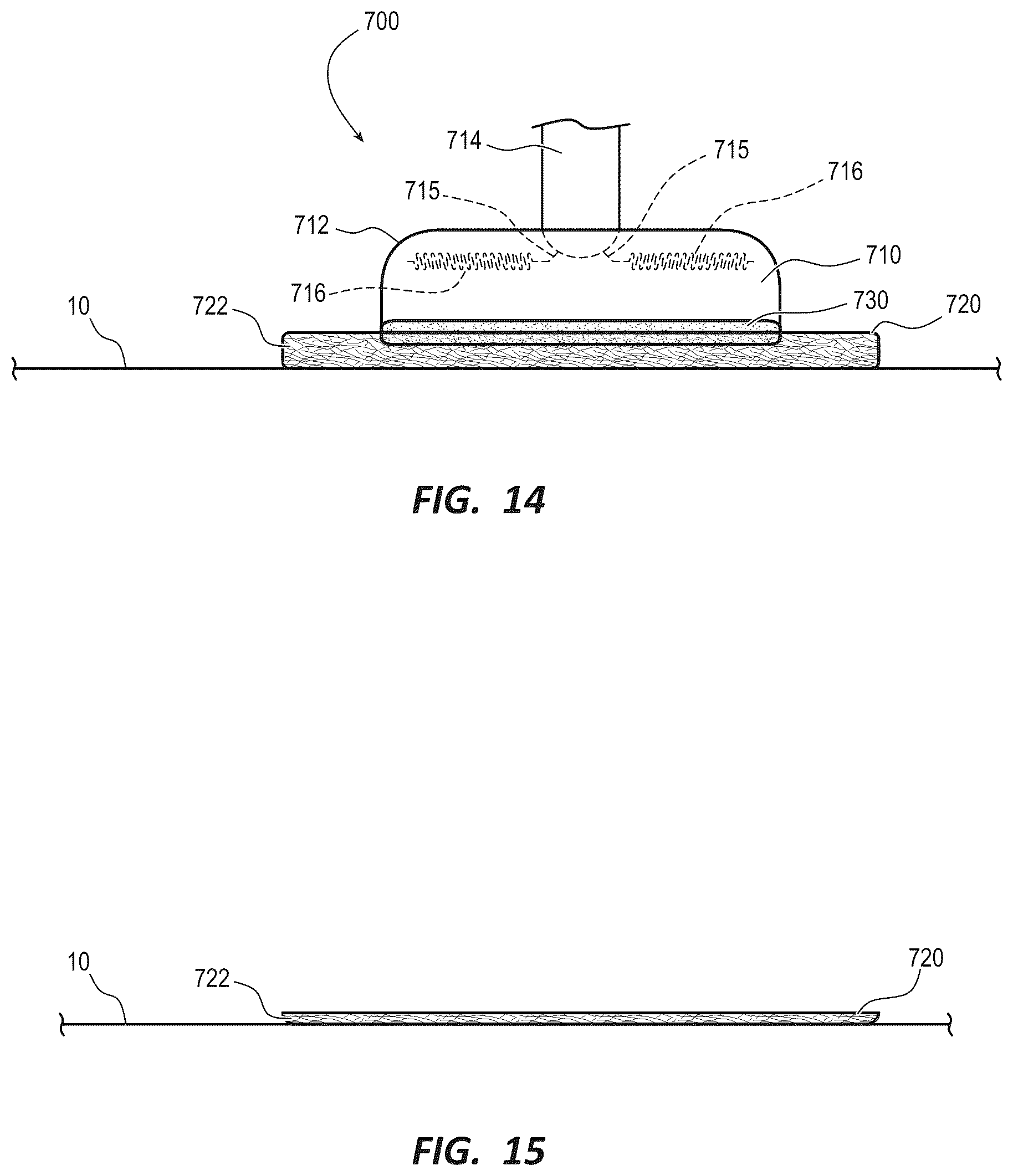 Patent US12310802 Figure 4 – Nanofiber adhesives for navigation tracker fixation