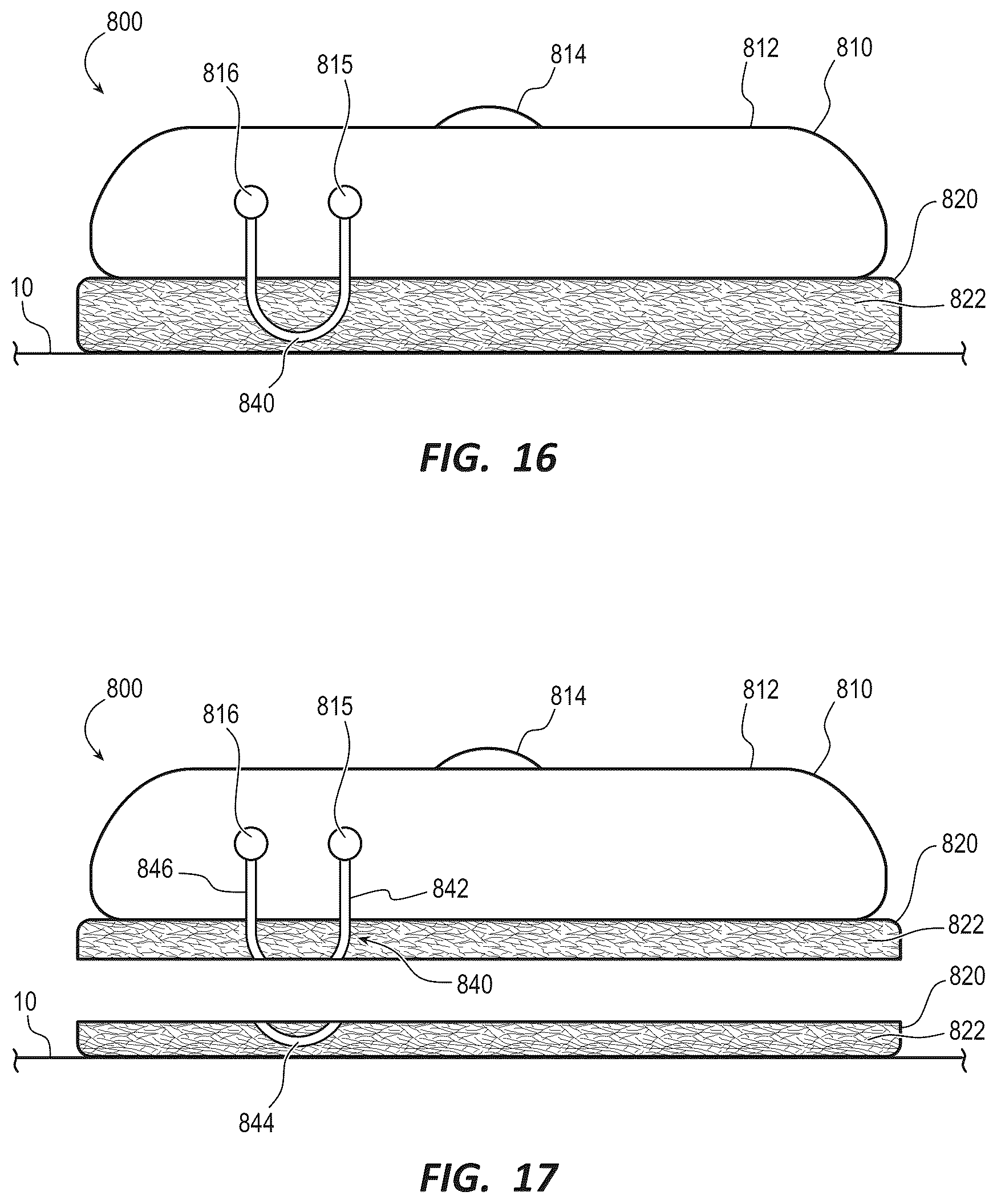 Patent US12310802 Figure 5 – Nanofiber adhesives for navigation tracker fixation
