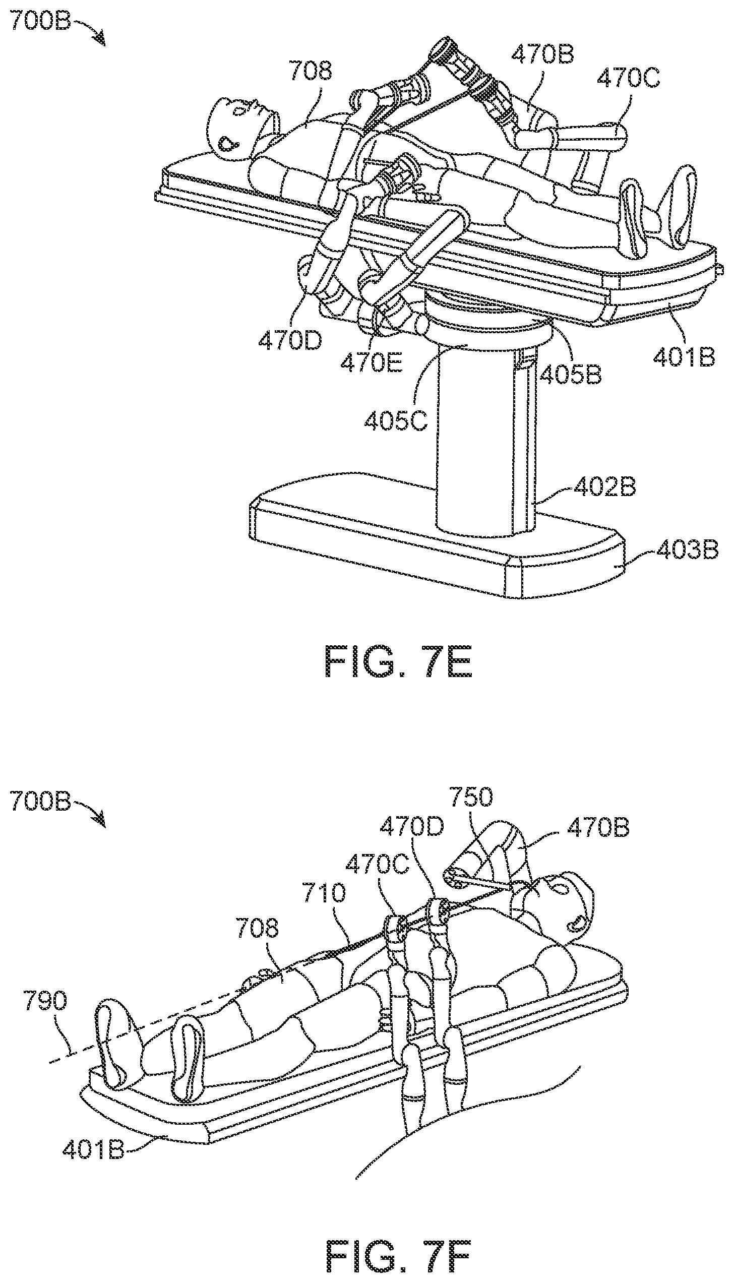 Patent US12310804 Figure 20 – Surgical platform with adjustable arm supports