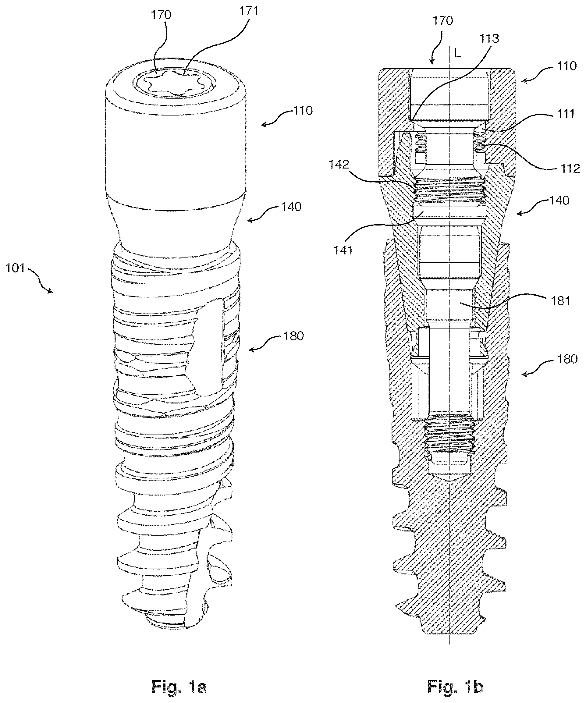 Patent US12310806 Figure 1 – Dental component with an interface
