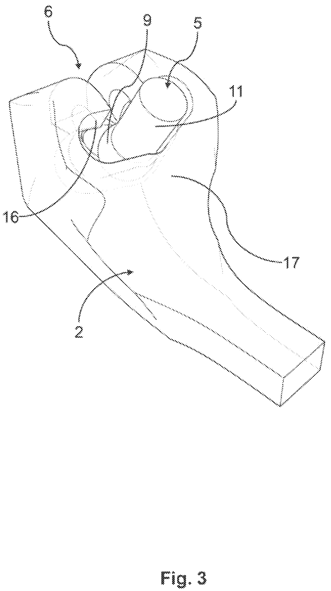 Patent US12310807 Figure 3 – Device for simulating jaw movements and a method for generating the device
