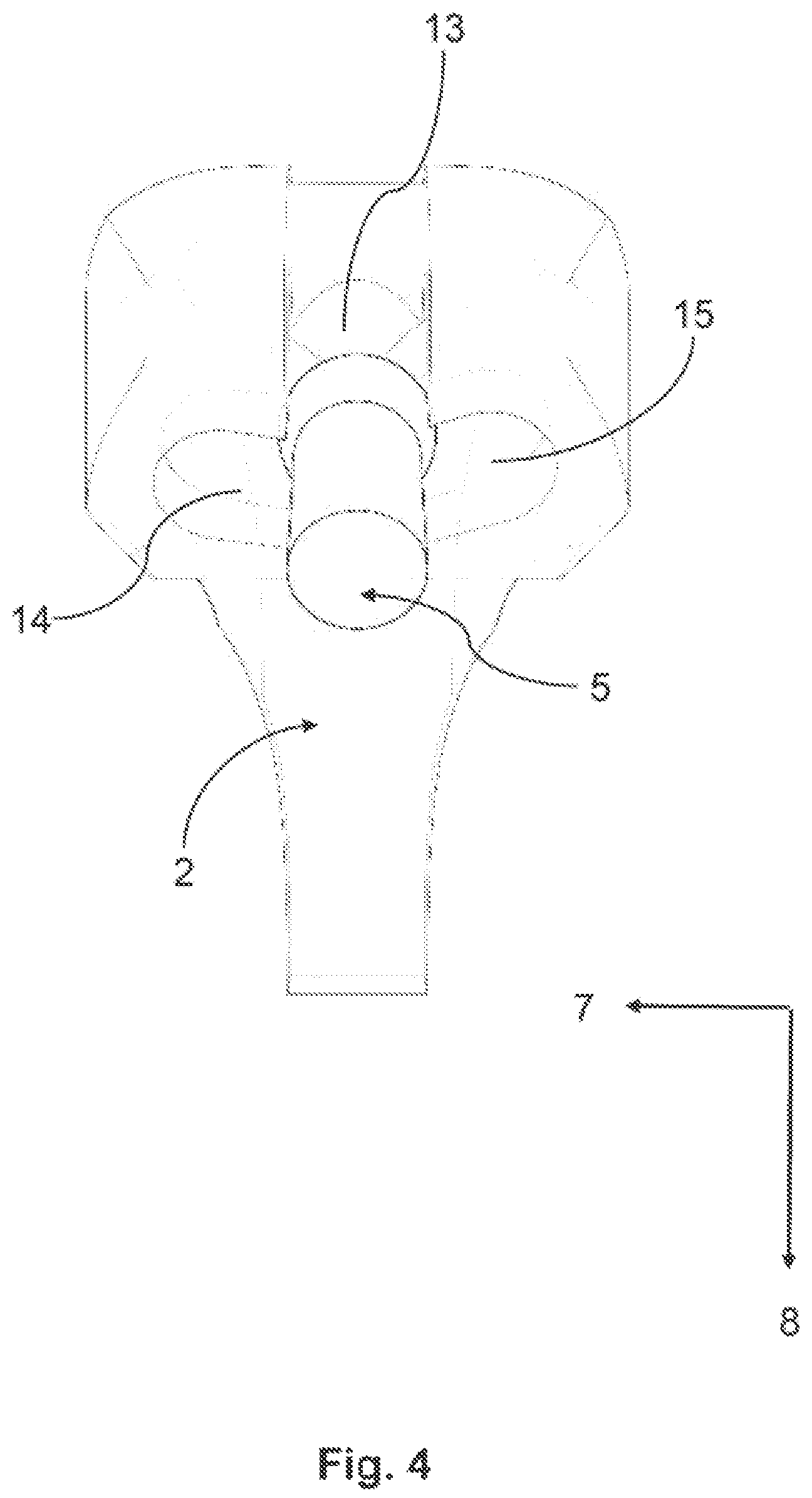 Patent US12310807 Figure 4 – Device for simulating jaw movements and a method for generating the device
