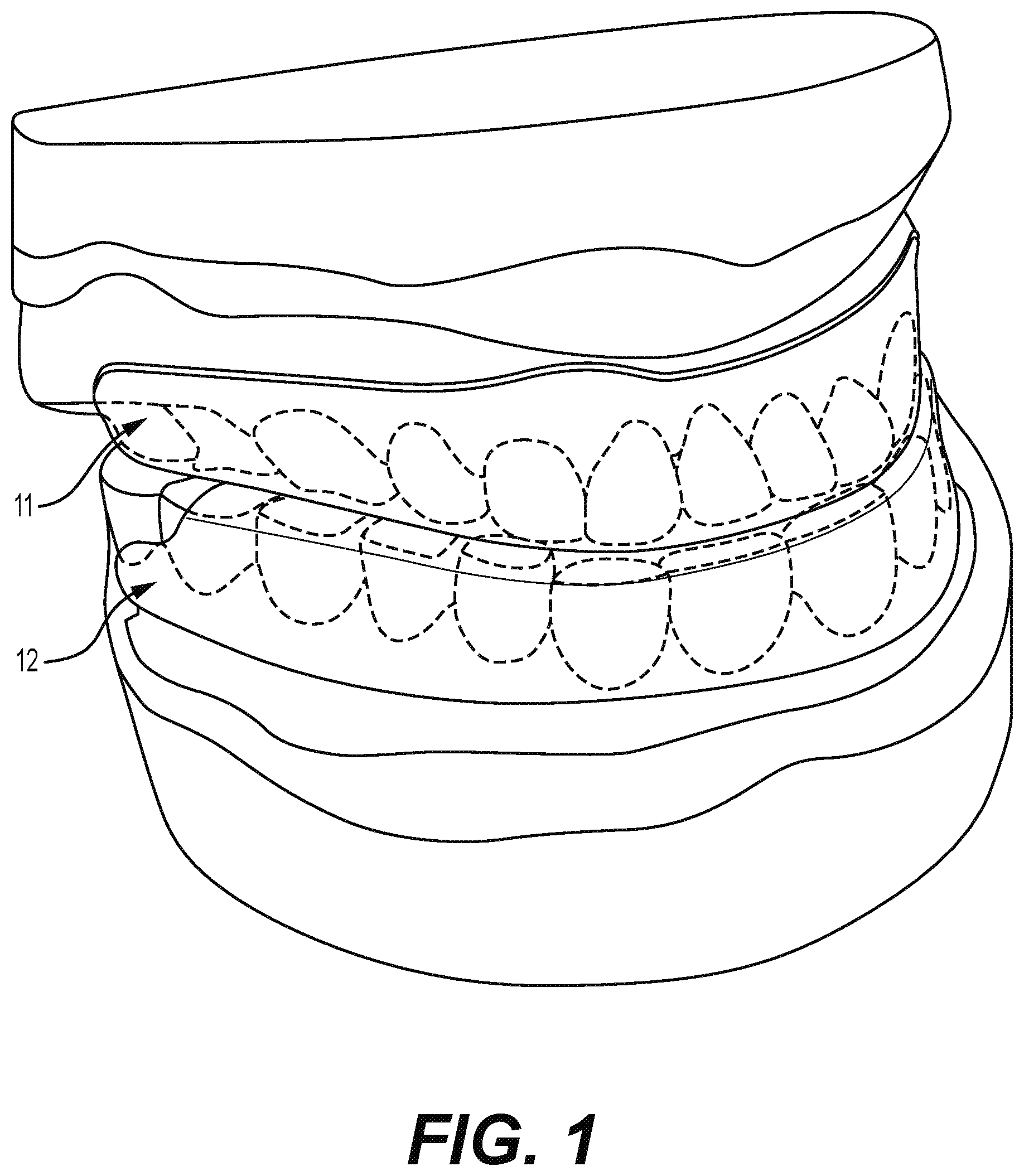 Patent US12310812 — Multifunctional oral appliance — Figure 1