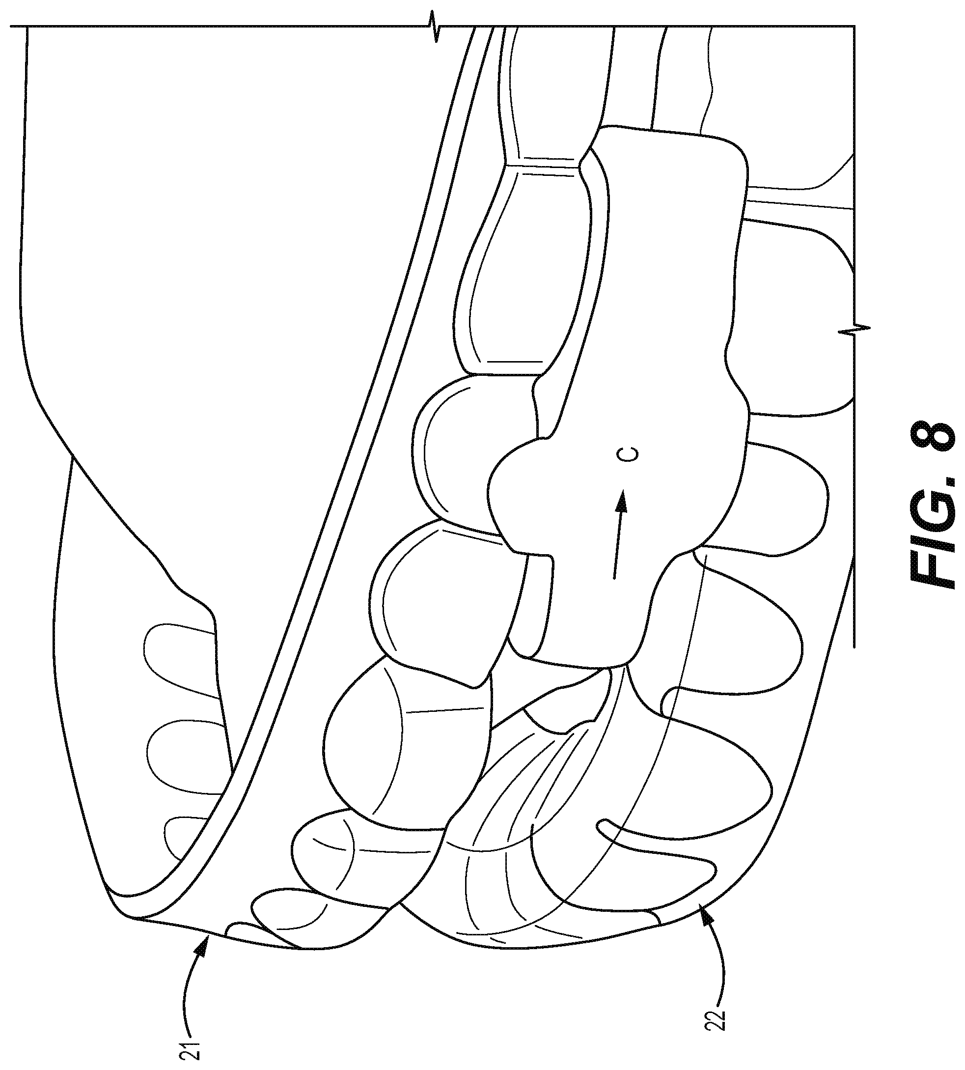Patent US12310812 Figure 8 – Multifunctional oral appliance