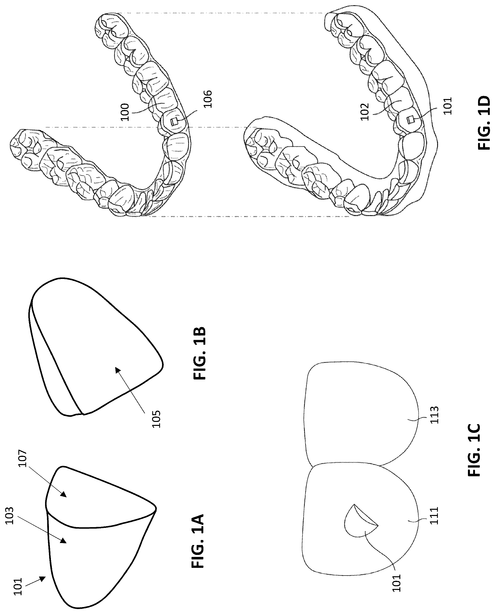 Patent US12310813 Figure 1 – Orthodontic attachment devices