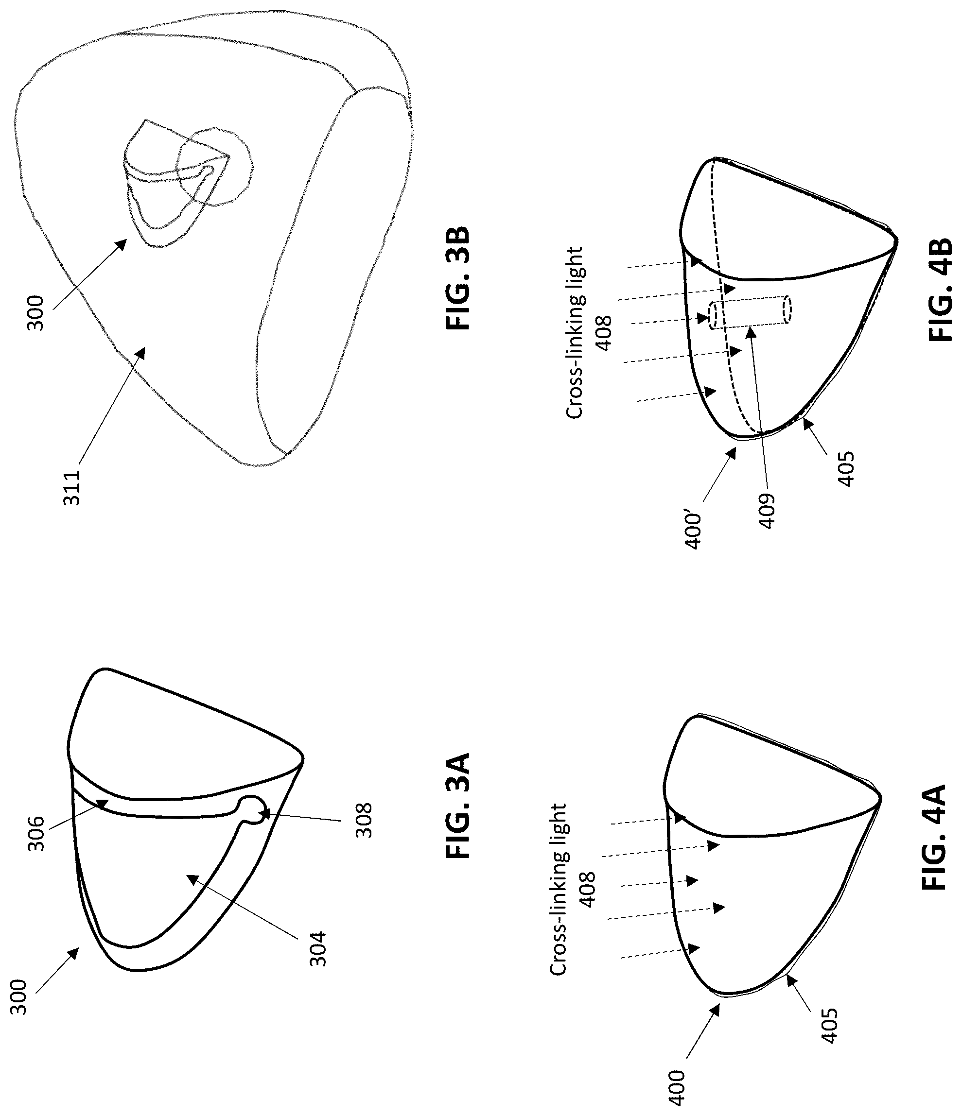 Patent US12310813 Figure 3 – Orthodontic attachment devices