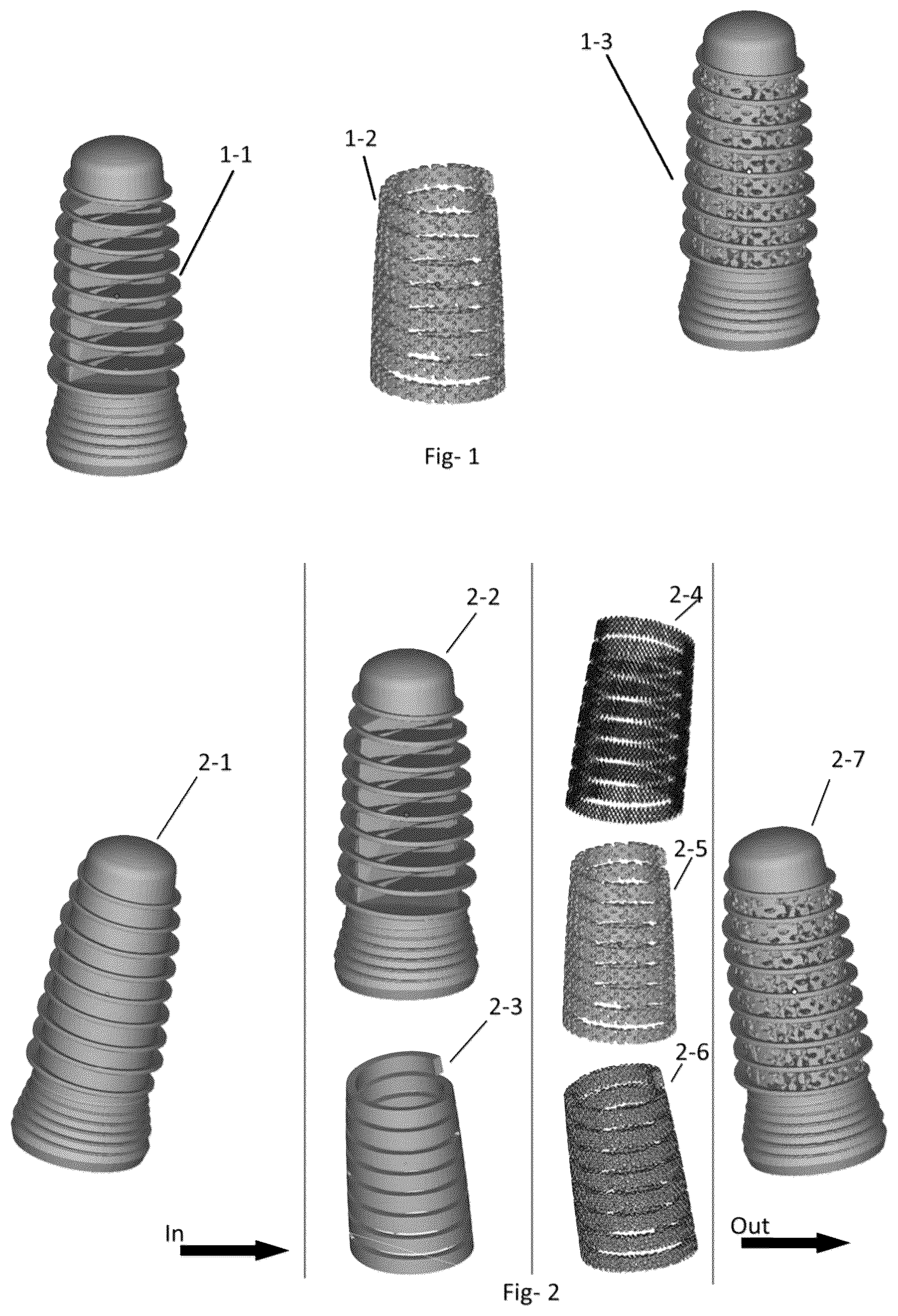 Patent US12310815 Figure 1 – Dental implant and self-locking fastening element with heterogeneousporous structures, and method for its production