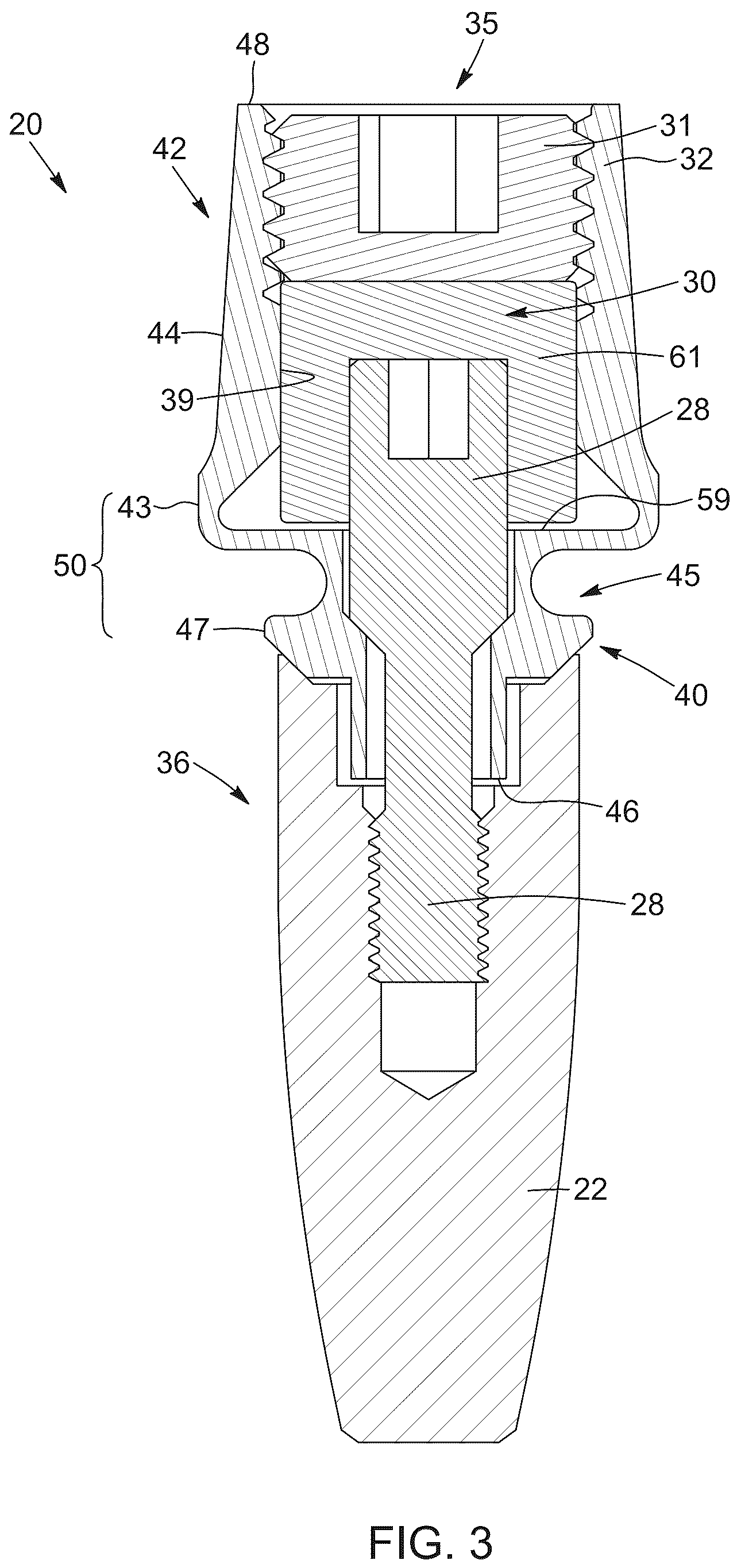 Patent US12310816 Figure 3 – Flexible abutment for use with dental implant