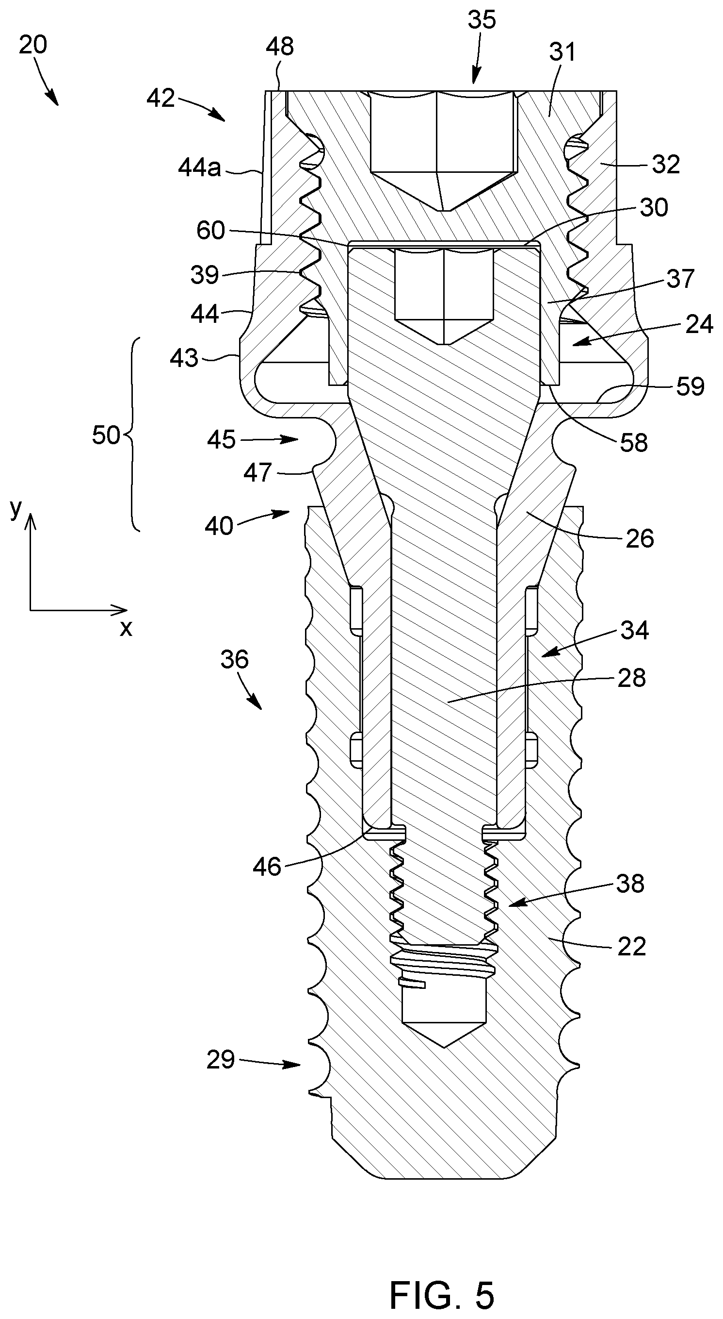 Patent US12310816 Figure 5 – Flexible abutment for use with dental implant