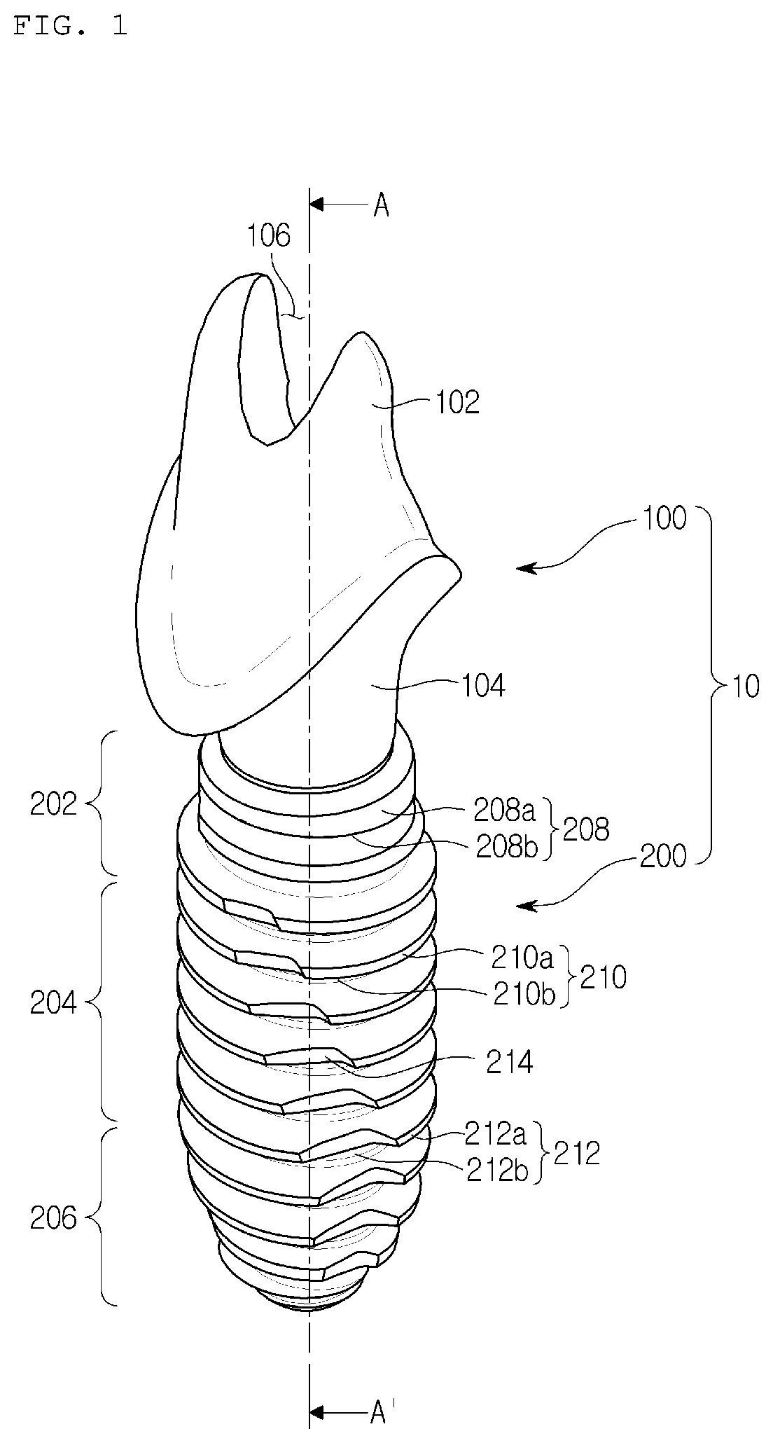 Patent US12310817 Figure 1 – Fixture engagement structure, fixture and dental implant assembly