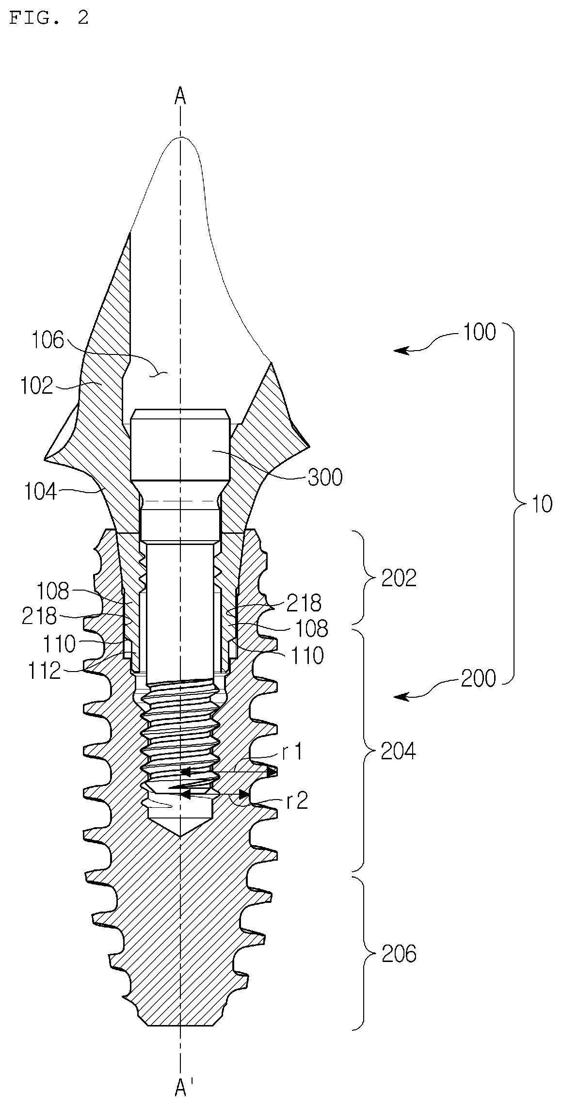 Patent US12310817 Figure 2 – Fixture engagement structure, fixture and dental implant assembly