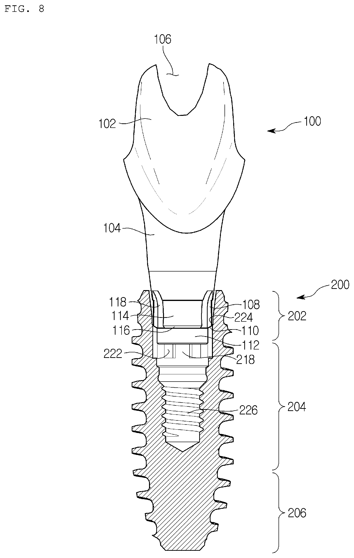 Patent US12310817 Figure 7 – Fixture engagement structure, fixture and dental implant assembly