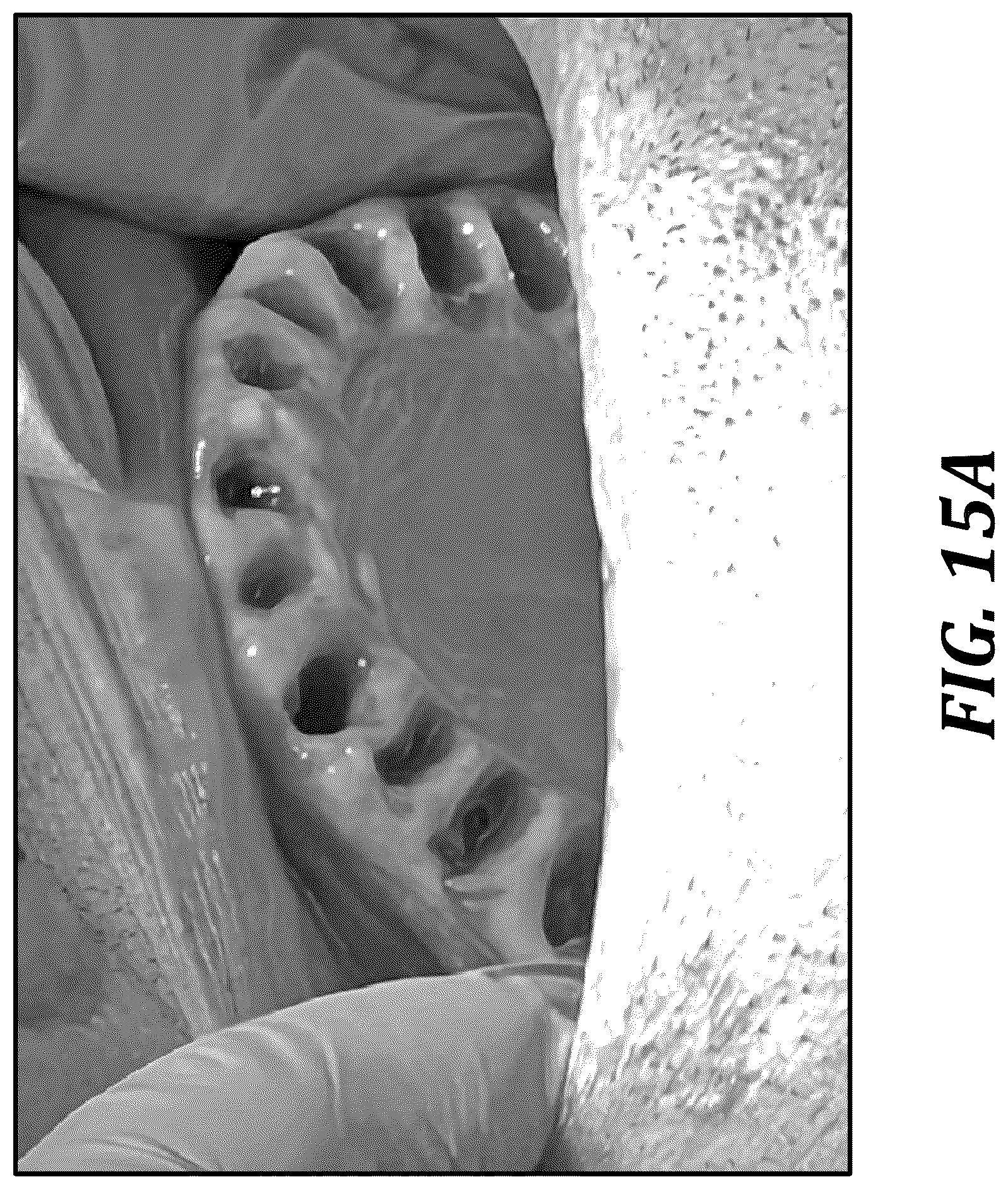 Patent US12310818 Figure 16 – Process for preparing a patient's jaw for a full arch teeth replacement