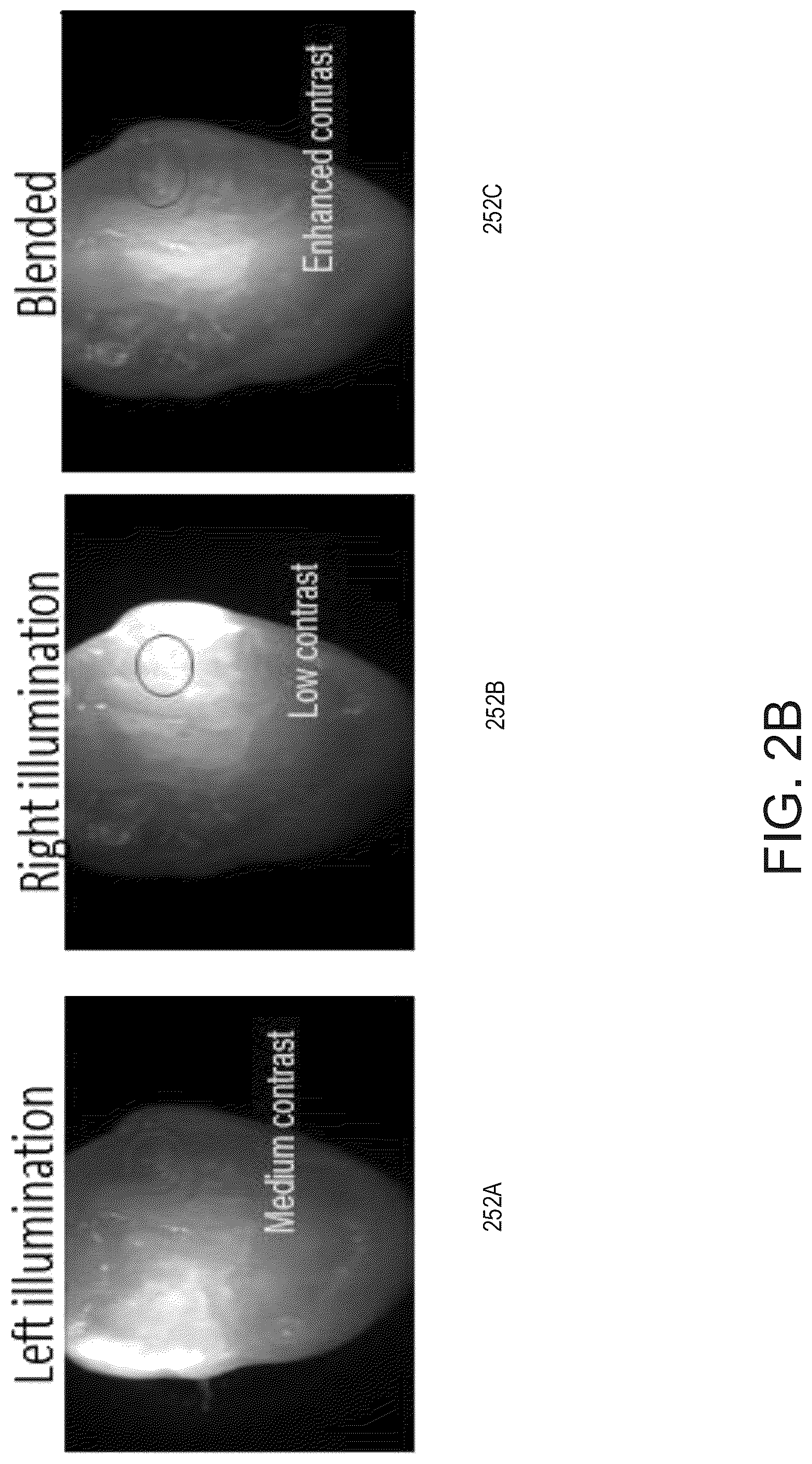 Patent US12310819 Figure 6 – Intraoral scanner with illumination sequencing and controlled polarization