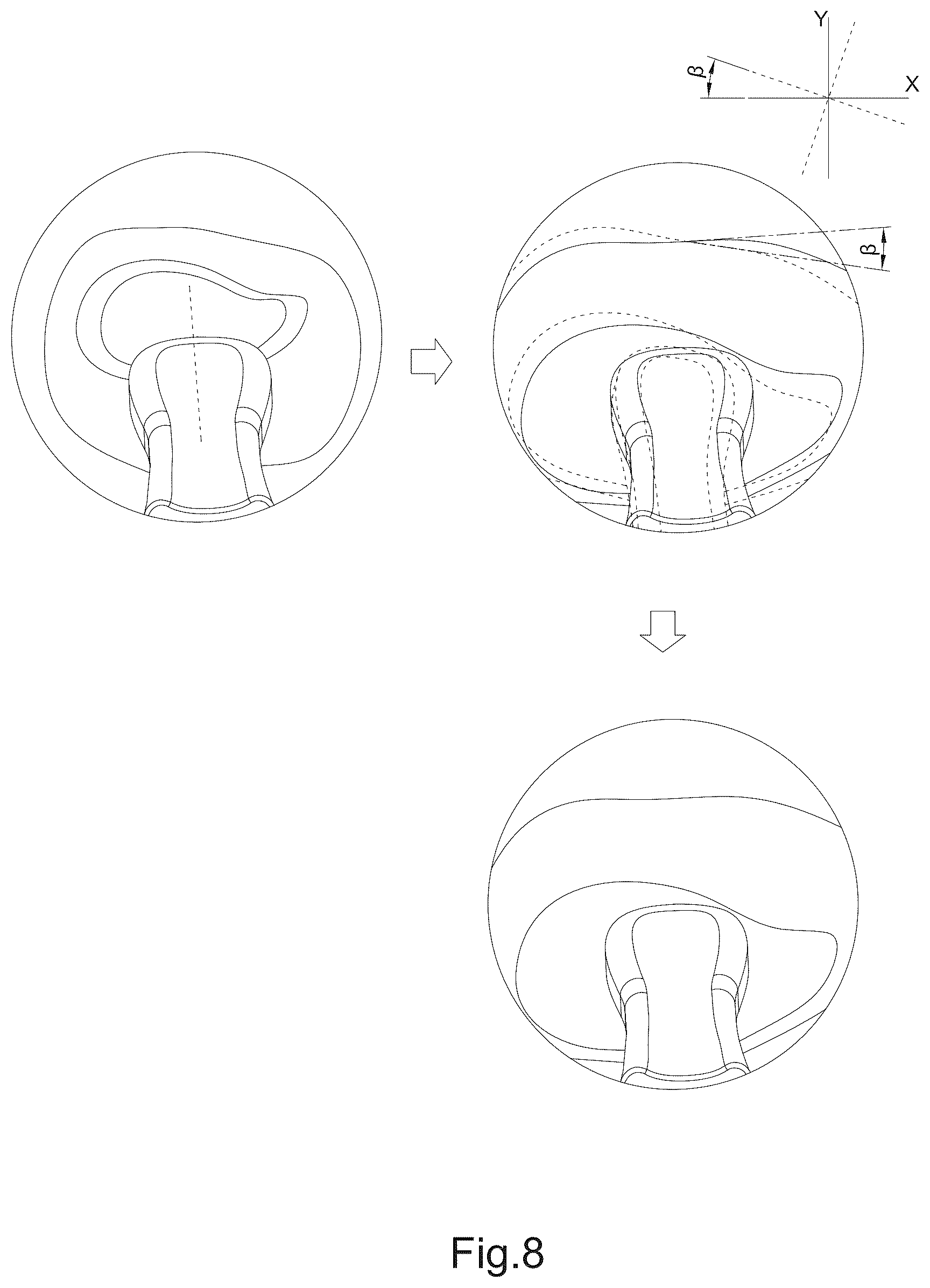 Patent US12310820 Figure 10 – Image processing method and operation interface for ear cleaning arrangement