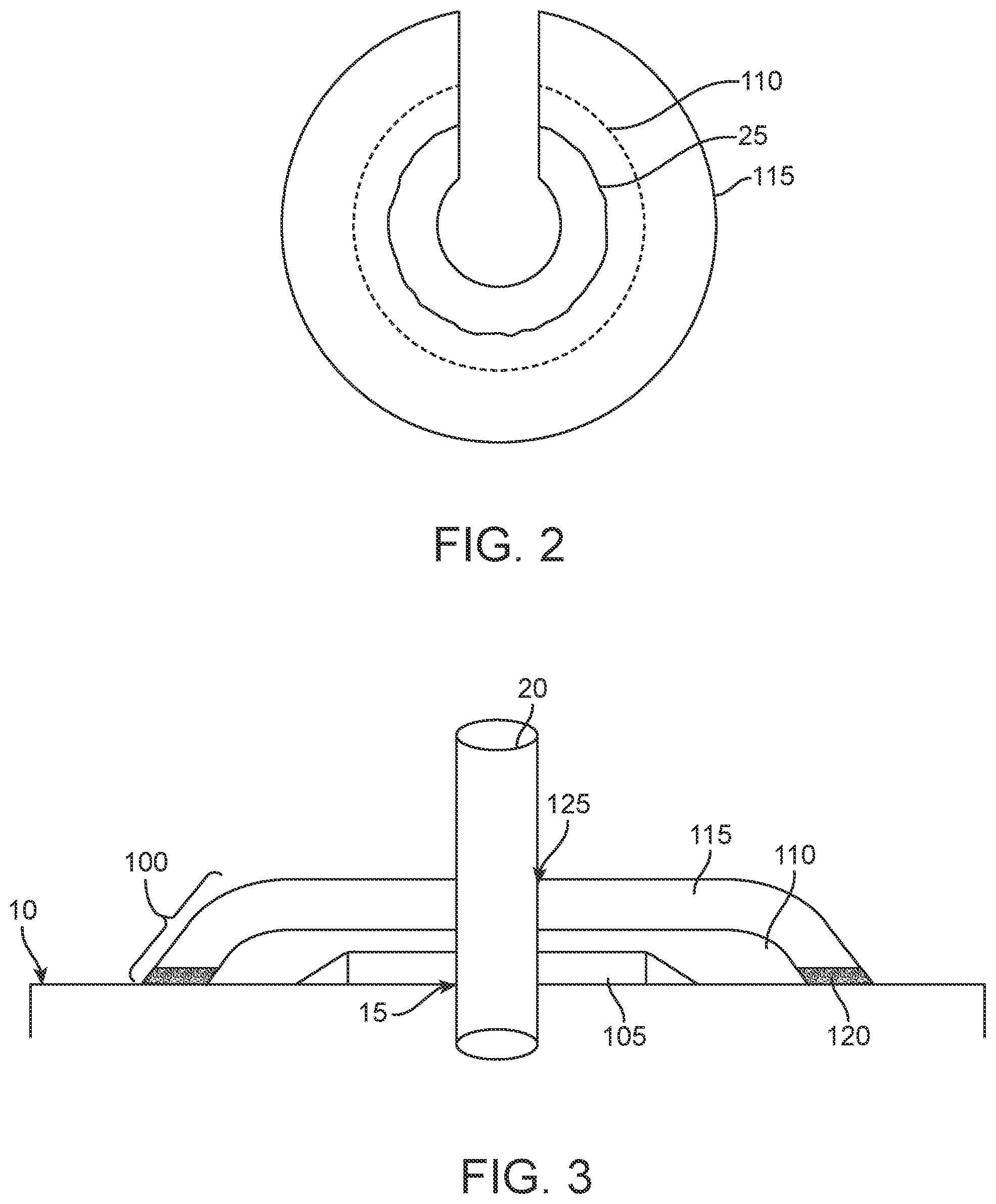 Patent US12310822 Figure 2 – Multi-layered dressing