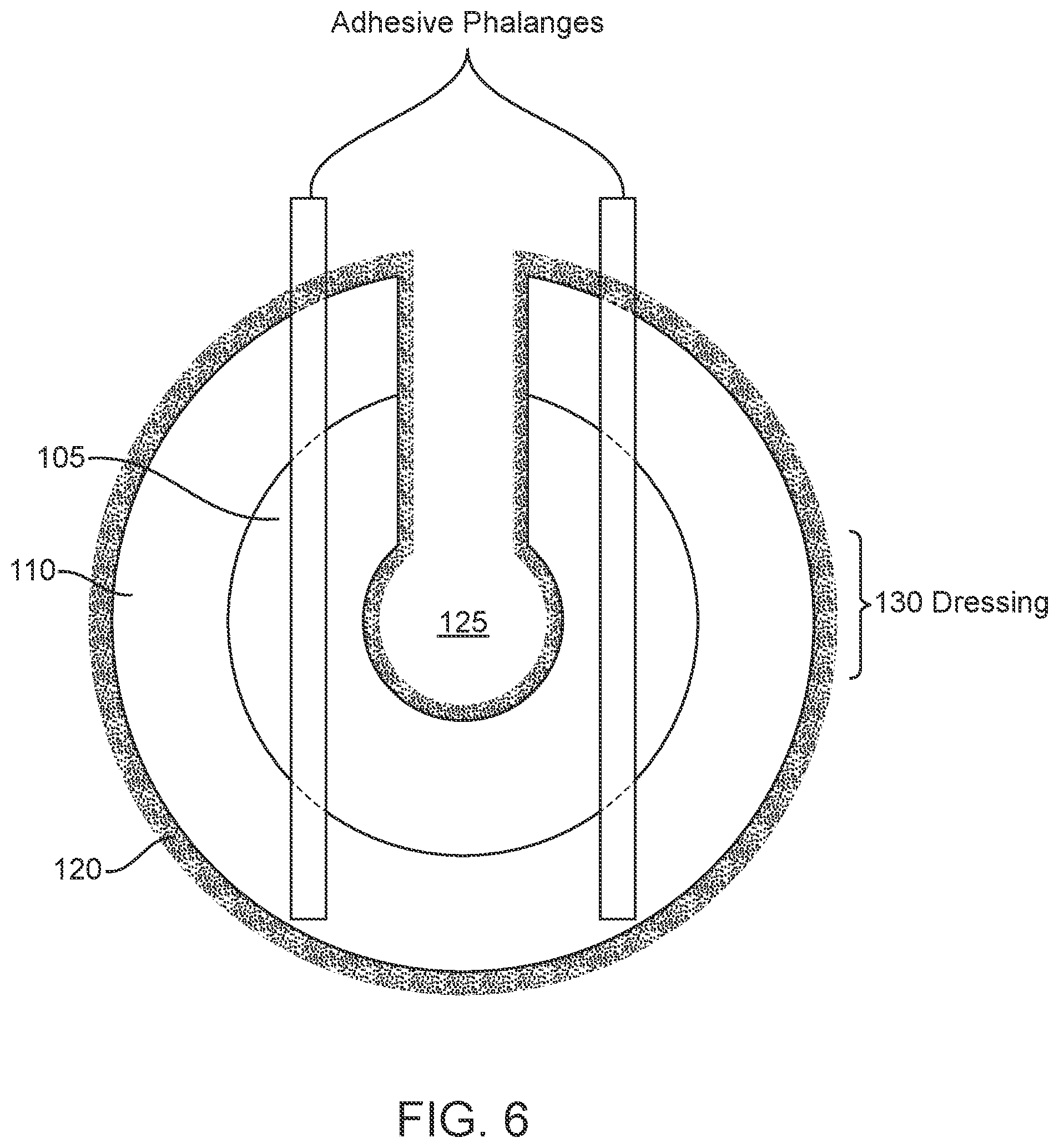 Patent US12310822 Figure 5 – Multi-layered dressing