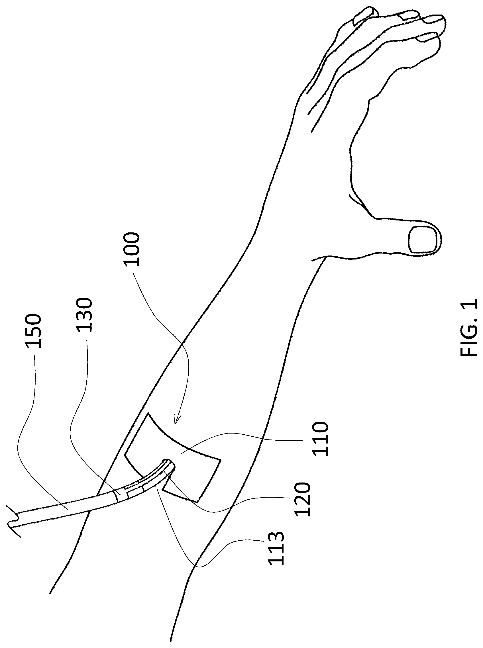 Patent US12310824 Figure 1 – Surgical dressing for drains