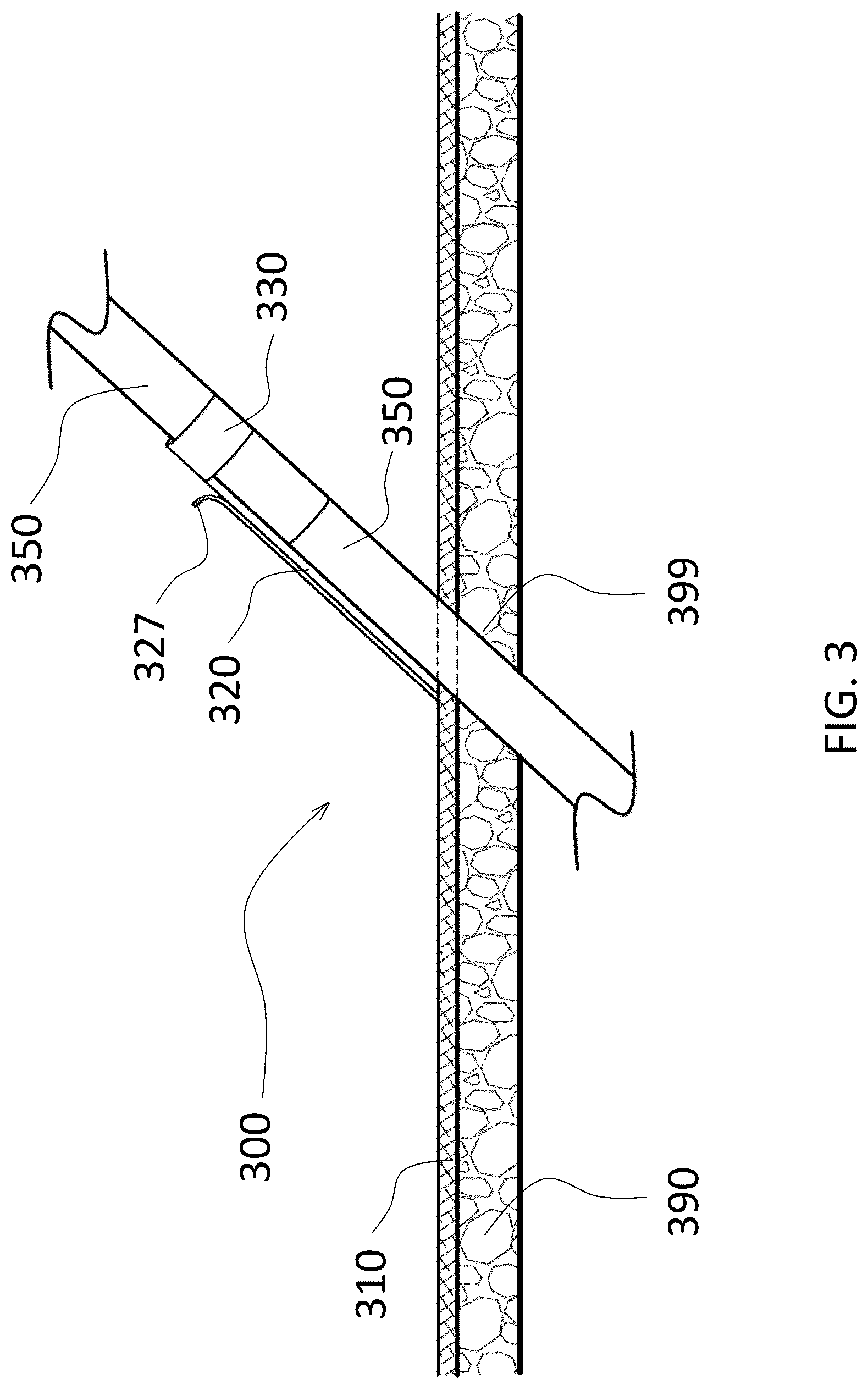 Patent US12310824 Figure 3 – Surgical dressing for drains