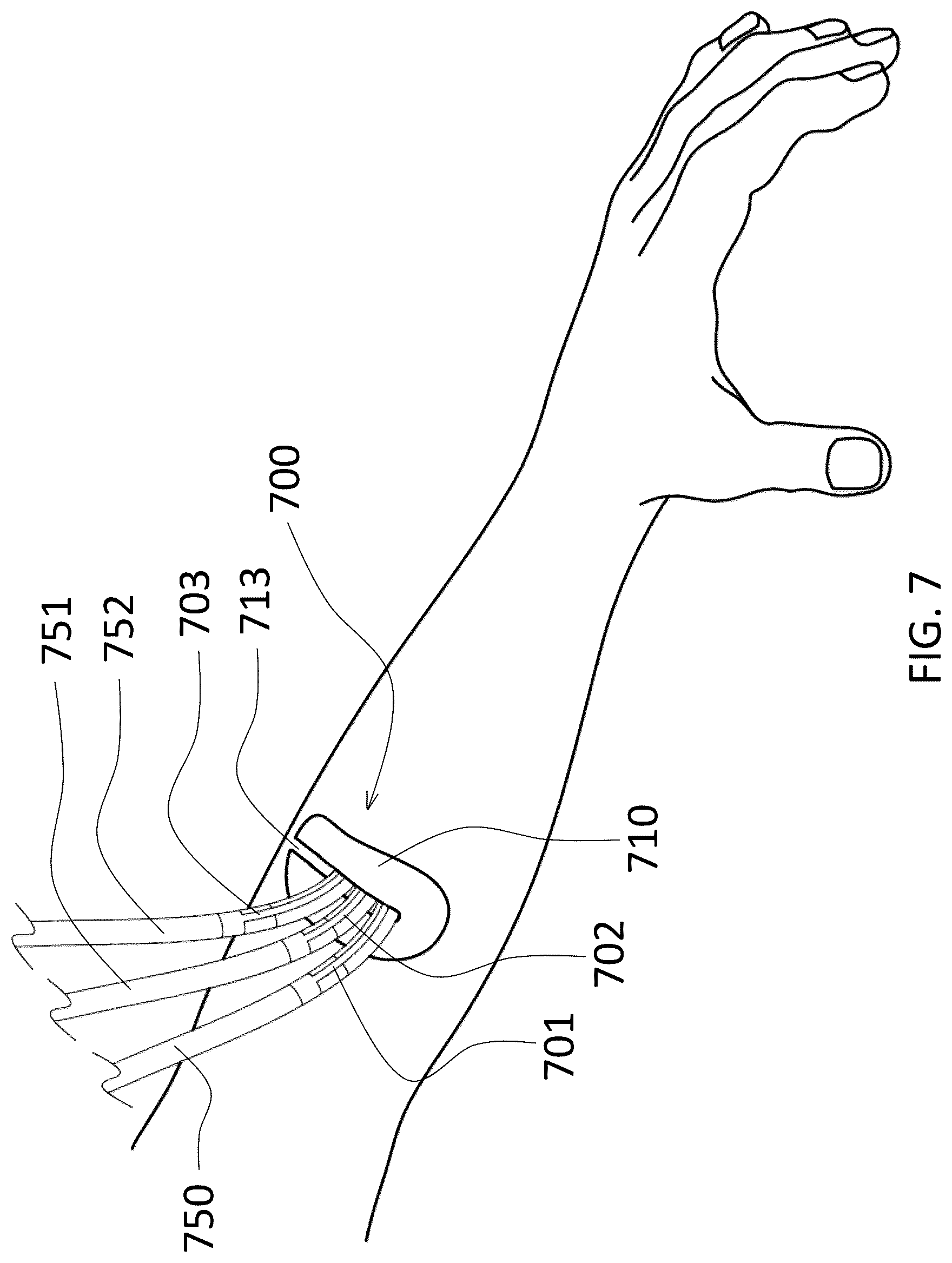 Patent US12310824 Figure 7 – Surgical dressing for drains